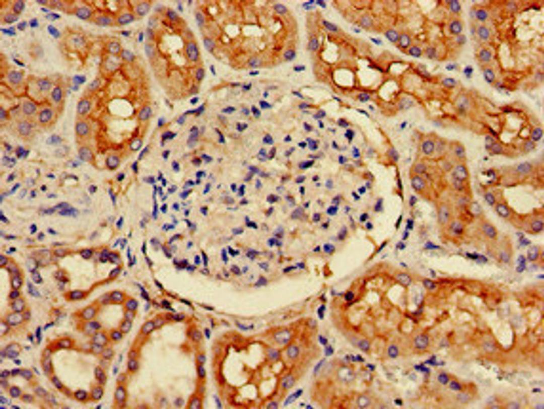 Immunohistochemistry of paraffin-embedded human kidney tissue using CSB-PA847226LA01HU at dilution of 1:100
