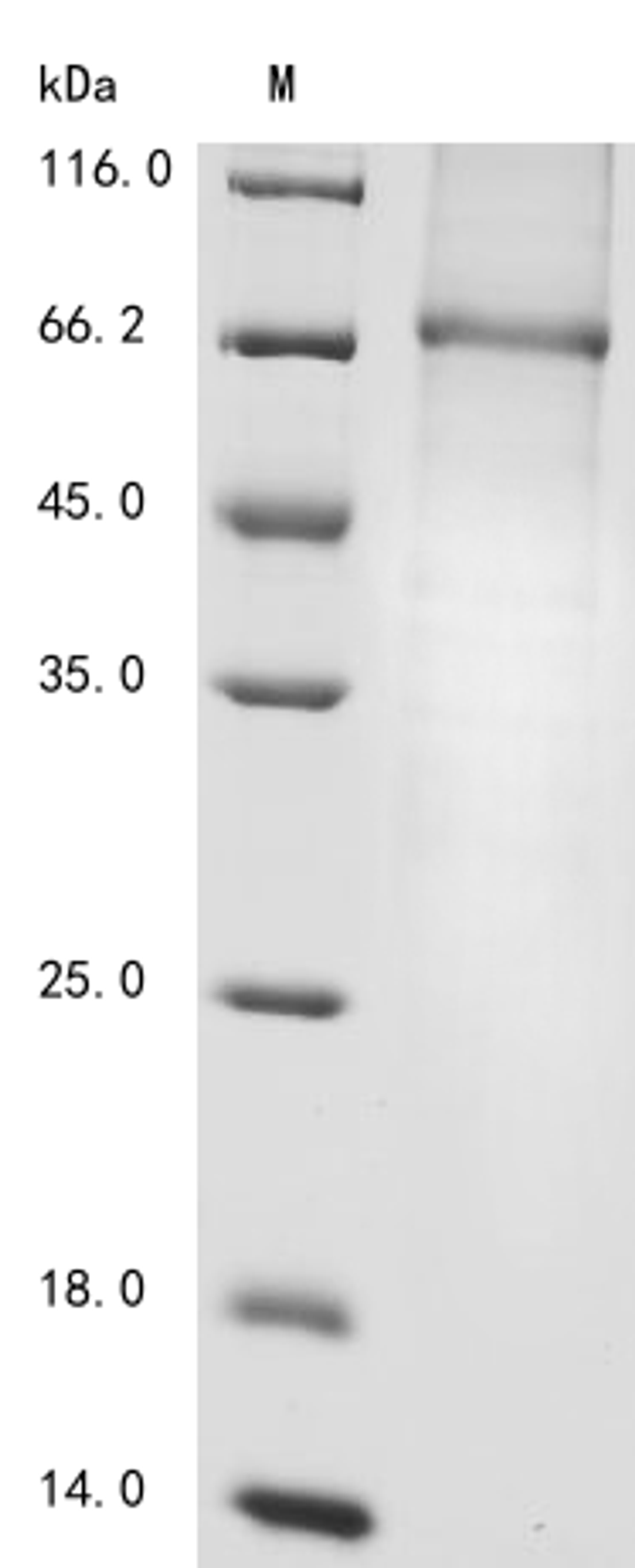 (Tris-Glycine gel) Discontinuous SDS-PAGE (reduced) with 5% enrichment gel and 15% separation gel.