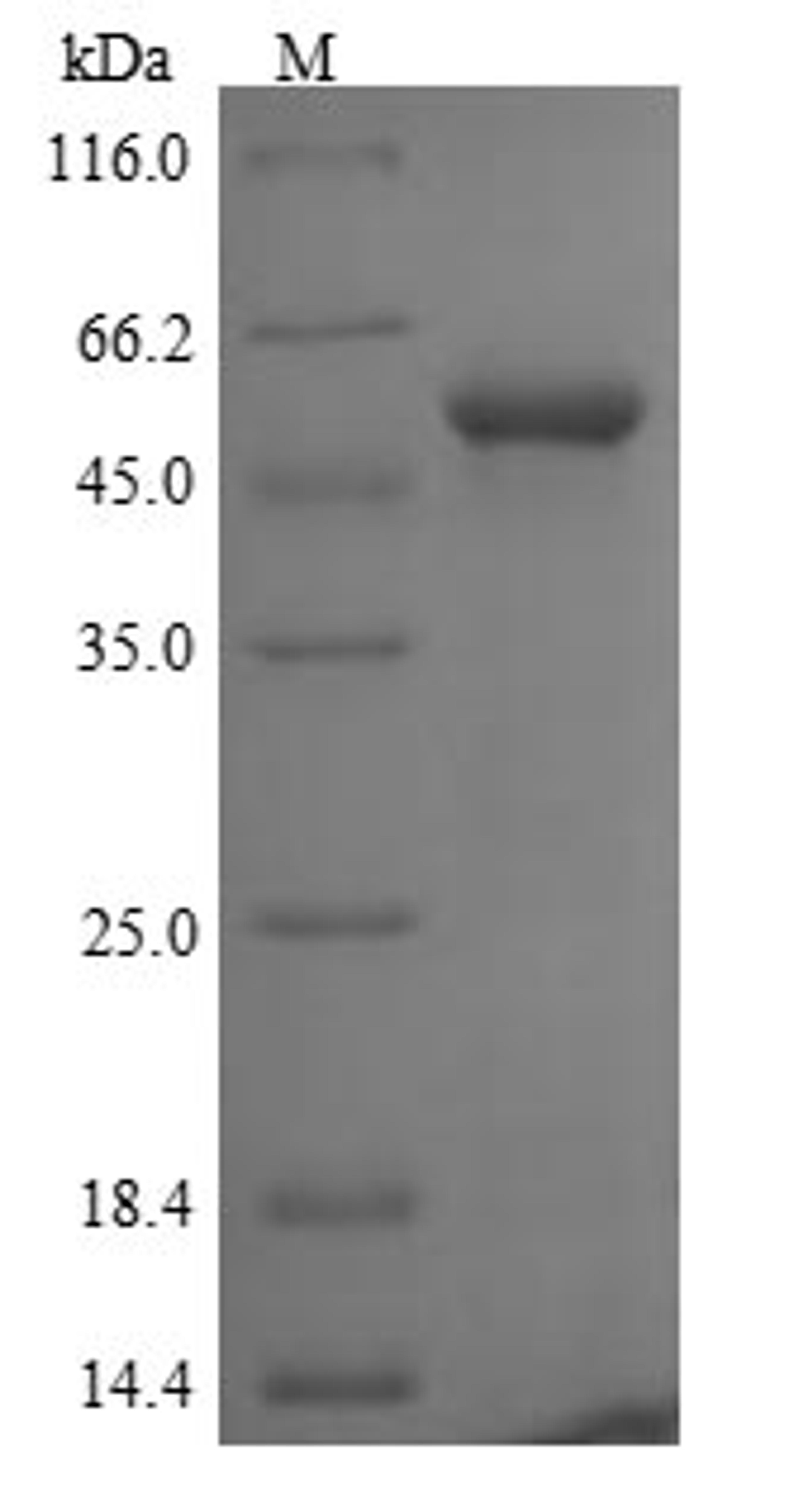 (Tris-Glycine gel) Discontinuous SDS-PAGE (reduced) with 5% enrichment gel and 15% separation gel.