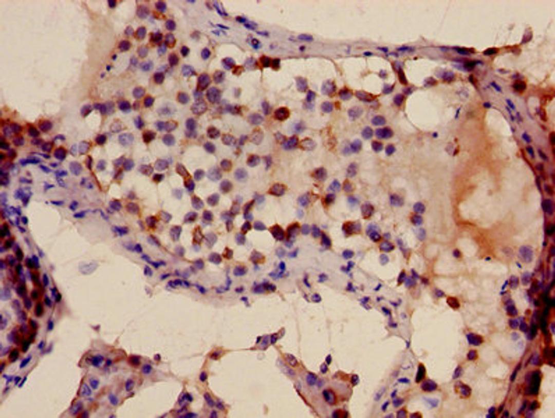 Immunohistochemistry of paraffin-embedded human testis tissue using CSB-PA702134LA01HU at dilution of 1:100