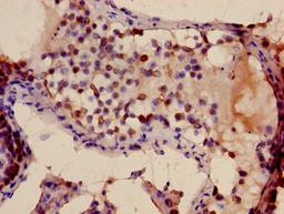 Immunohistochemistry of paraffin-embedded human testis tissue using CSB-PA702134LA01HU at dilution of 1:100