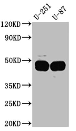 Western Blot. Positive WB detected in: U-251 whole cell lysate, U-87 whole cell lysate. All lanes: PAI1 Antibody at 1:1000. Secondary. Goat polyclonal to rabbit IgG at 1/50000 dilution. Predicted band size: 46, 44 kDa. Observed band size: 45 kDa. 