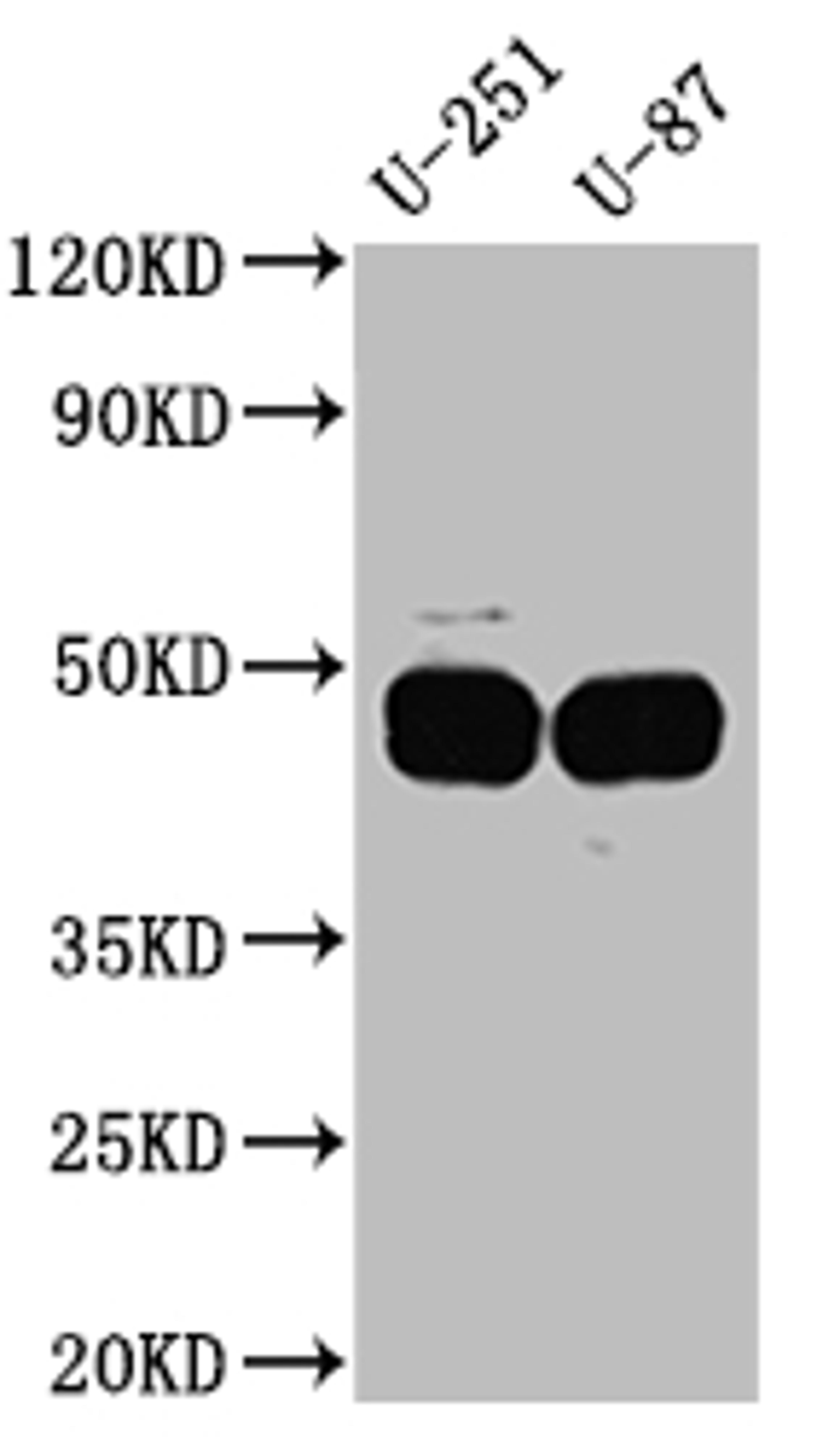 Western Blot. Positive WB detected in: U-251 whole cell lysate, U-87 whole cell lysate. All lanes: PAI1 Antibody at 1:1000. Secondary. Goat polyclonal to rabbit IgG at 1/50000 dilution. Predicted band size: 46, 44 kDa. Observed band size: 45 kDa. 