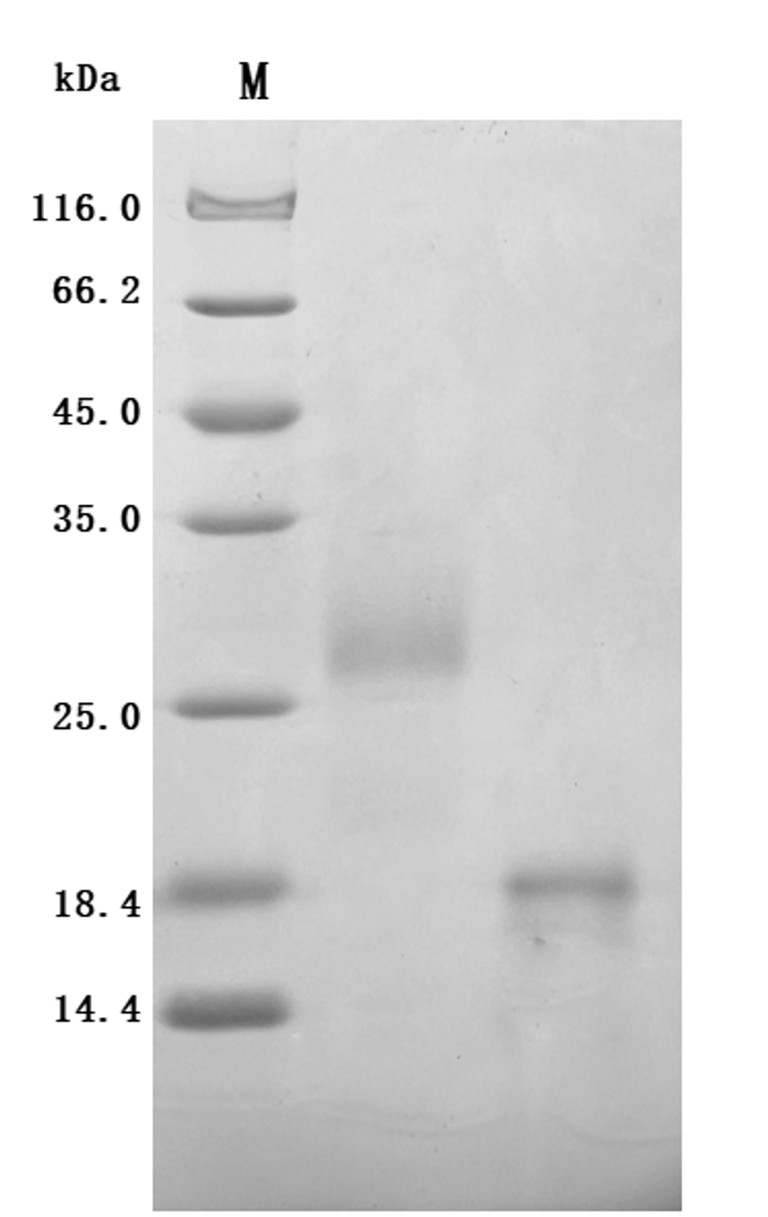 (Tris-Glycine gel) Discontinuous SDS-PAGE (reduced) with 5% enrichment gel and 15% separation gel.