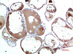 Immunohistochemical analysis of paraffin-embedded Human Thyroid Tissue using TTR Mouse mAb diluted at 1:200.