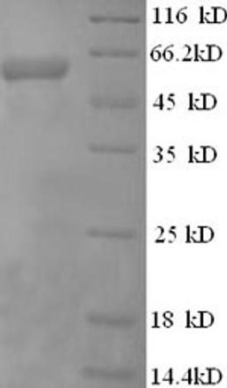 (Tris-Glycine gel) Discontinuous SDS-PAGE (reduced) with 5% enrichment gel and 15% separation gel.
