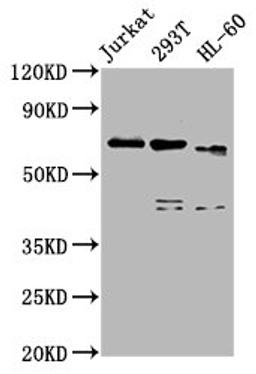 Western Blot. Positive WB detected in: Jurkat whole cell lysate, 293T whole cell lysate, HL60 whole cell lysate. All lanes: CBFA2T3 antibody at 5µg/ml. Secondary. Goat polyclonal to rabbit IgG at 1/50000 dilution. Predicted band size: 72, 63, 64, 8 kDa. Observed band size: 72 kDa