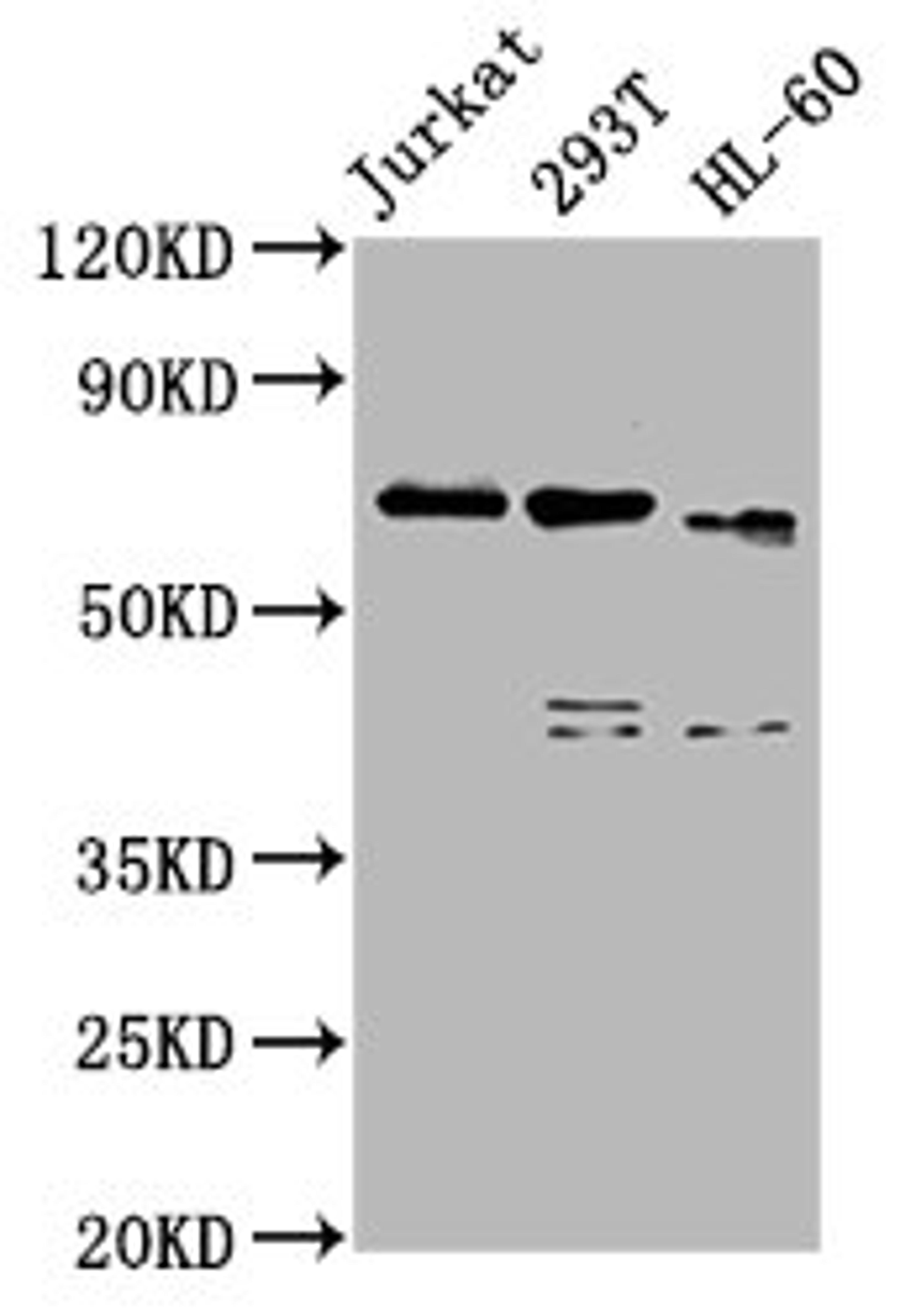 Western Blot. Positive WB detected in: Jurkat whole cell lysate, 293T whole cell lysate, HL60 whole cell lysate. All lanes: CBFA2T3 antibody at 5µg/ml. Secondary. Goat polyclonal to rabbit IgG at 1/50000 dilution. Predicted band size: 72, 63, 64, 8 kDa. Observed band size: 72 kDa