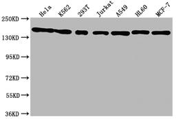 Western Blot. Positive WB detected in: Hela whole cell lysate, K562 whole cell lysate, 293T whole cell lysate, Jurkat whole cell lysate, A549 whole cell lysate, HL60 whole cell lysate, MCF-7 whole cell lysate. All lanes: SMC1A antibody at 1:1500. Secondary. Goat polyclonal to rabbit IgG at 1/50000 dilution. Predicted band size: 144 kDa. Observed band size: 144 kDa. 
