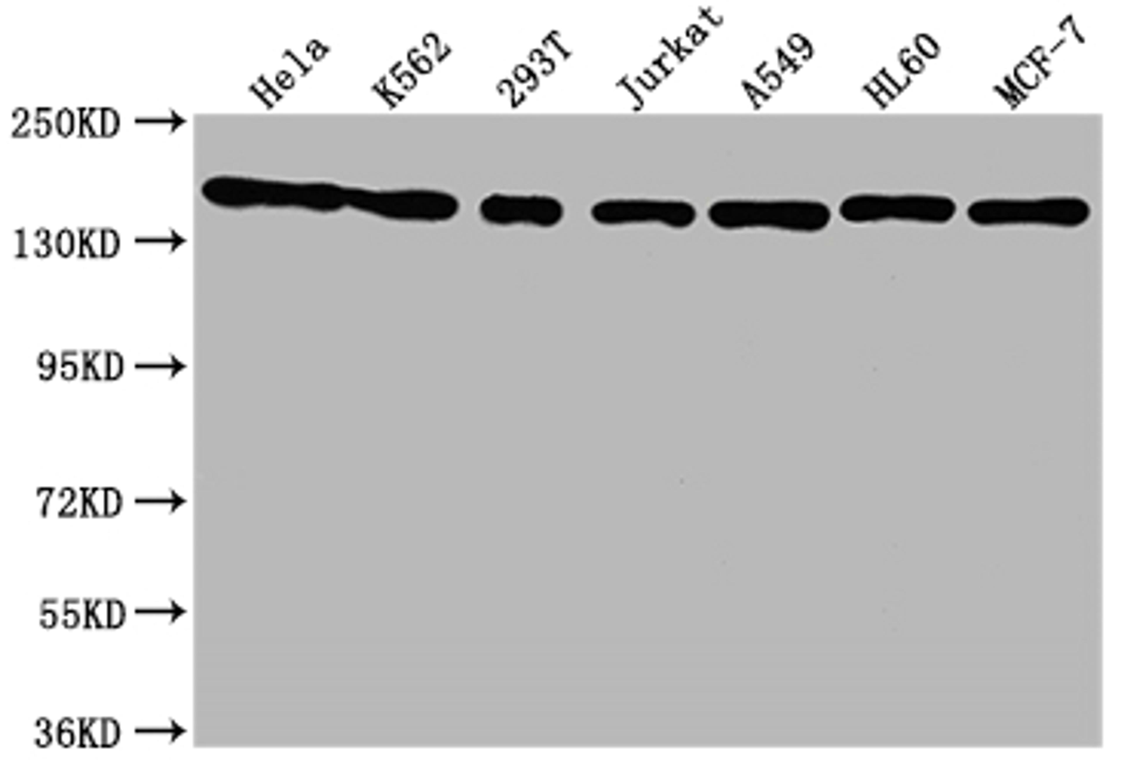Western Blot. Positive WB detected in: Hela whole cell lysate, K562 whole cell lysate, 293T whole cell lysate, Jurkat whole cell lysate, A549 whole cell lysate, HL60 whole cell lysate, MCF-7 whole cell lysate. All lanes: SMC1A antibody at 1:1500. Secondary. Goat polyclonal to rabbit IgG at 1/50000 dilution. Predicted band size: 144 kDa. Observed band size: 144 kDa. 