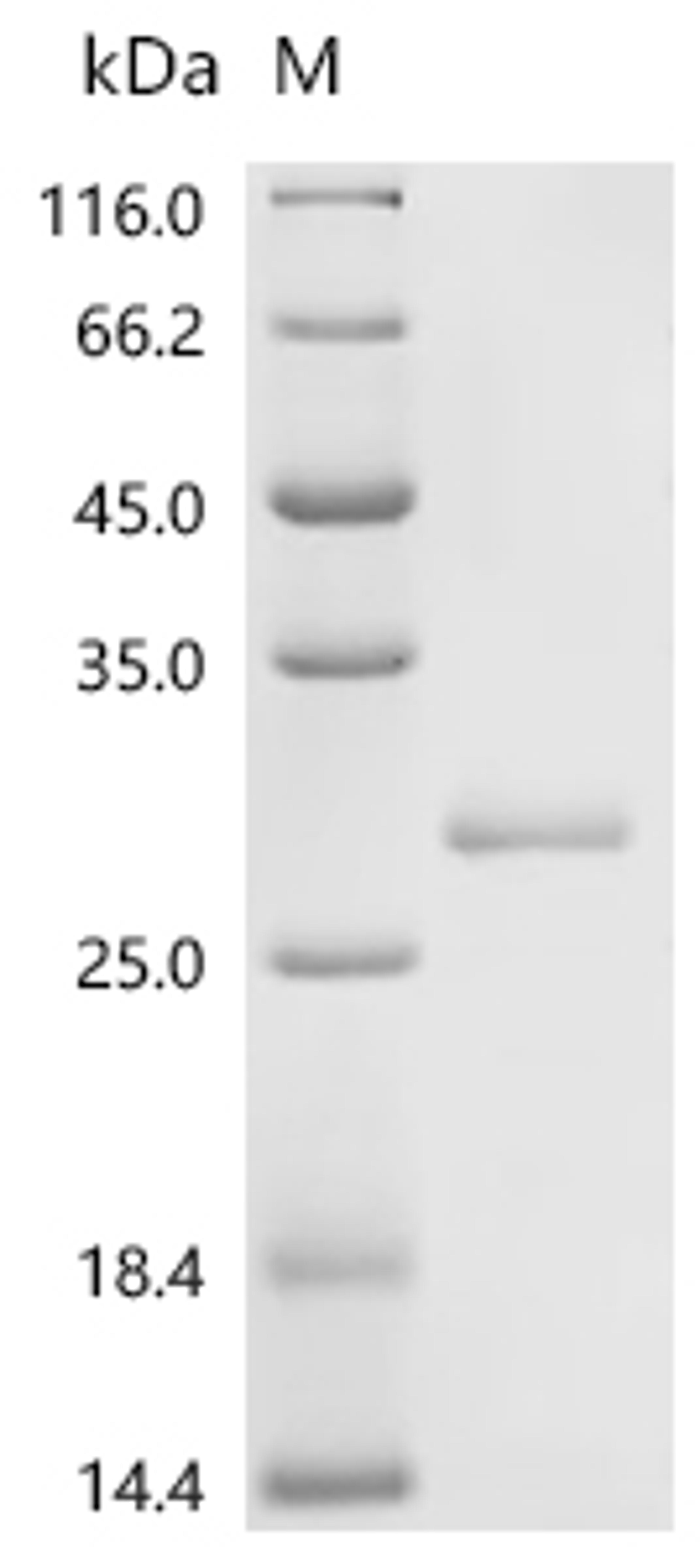 (Tris-Glycine gel) Discontinuous SDS-PAGE (reduced) with 5% enrichment gel and 15% separation gel.