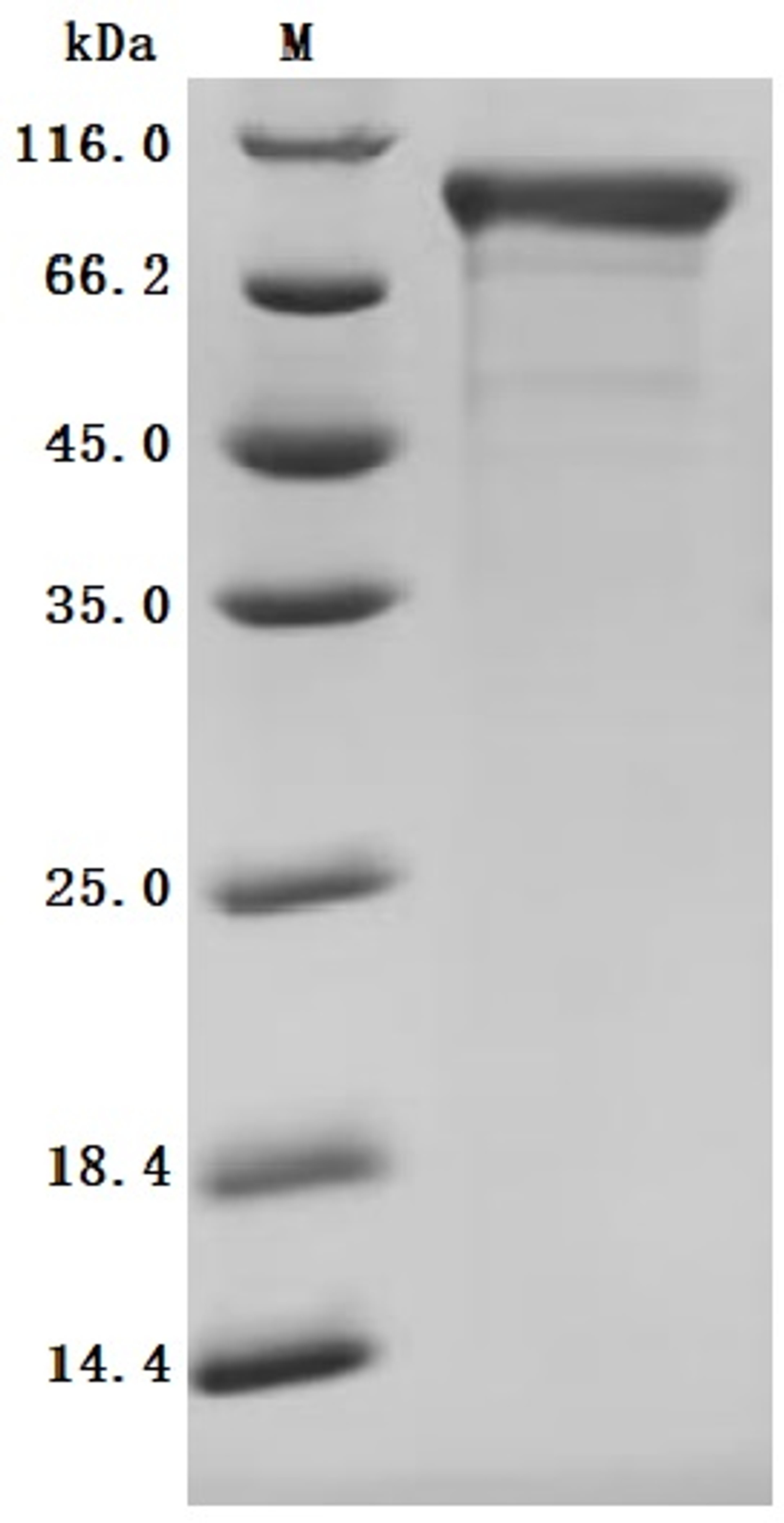 (Tris-Glycine gel) Discontinuous SDS-PAGE (reduced) with 5% enrichment gel and 15% separation gel.