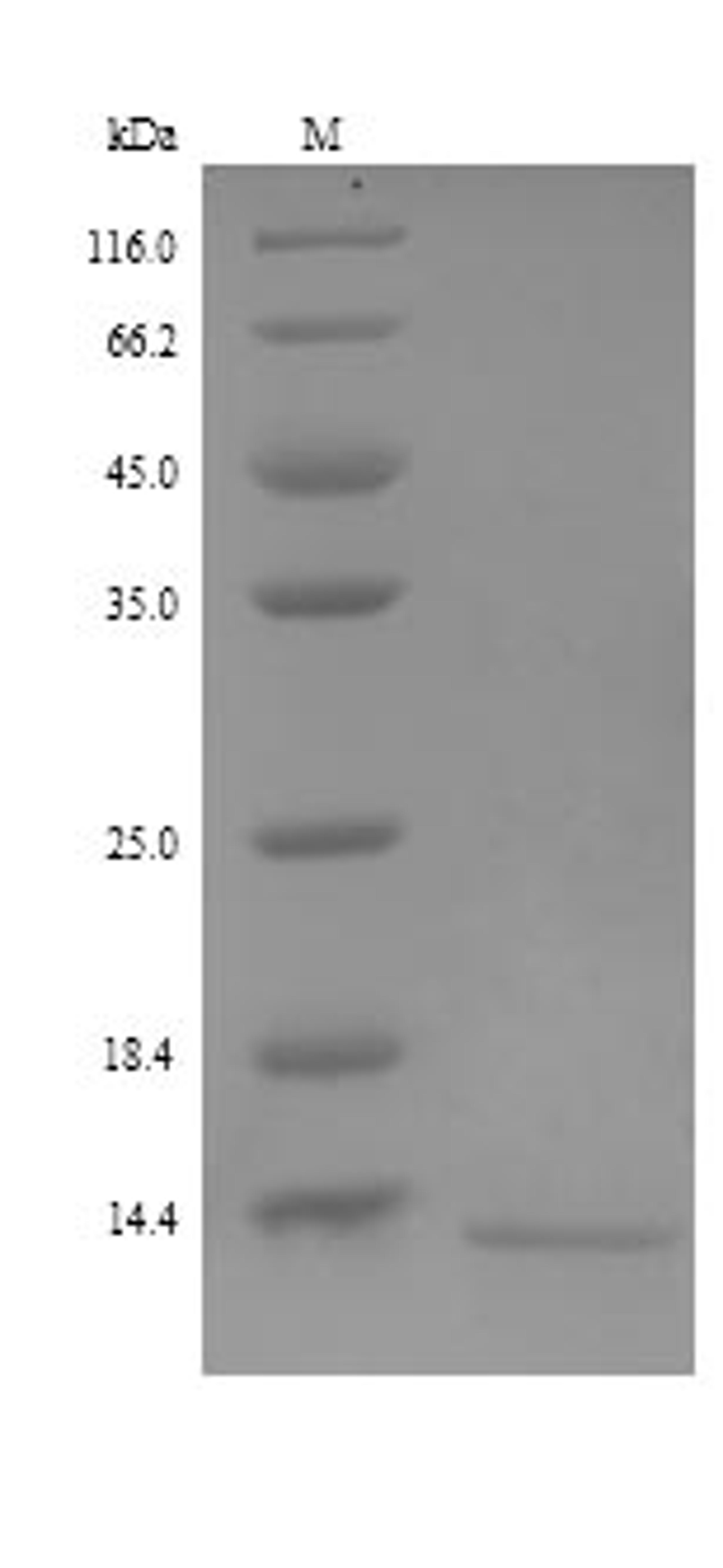 (Tris-Glycine gel) Discontinuous SDS-PAGE (reduced) with 5% enrichment gel and 15% separation gel.