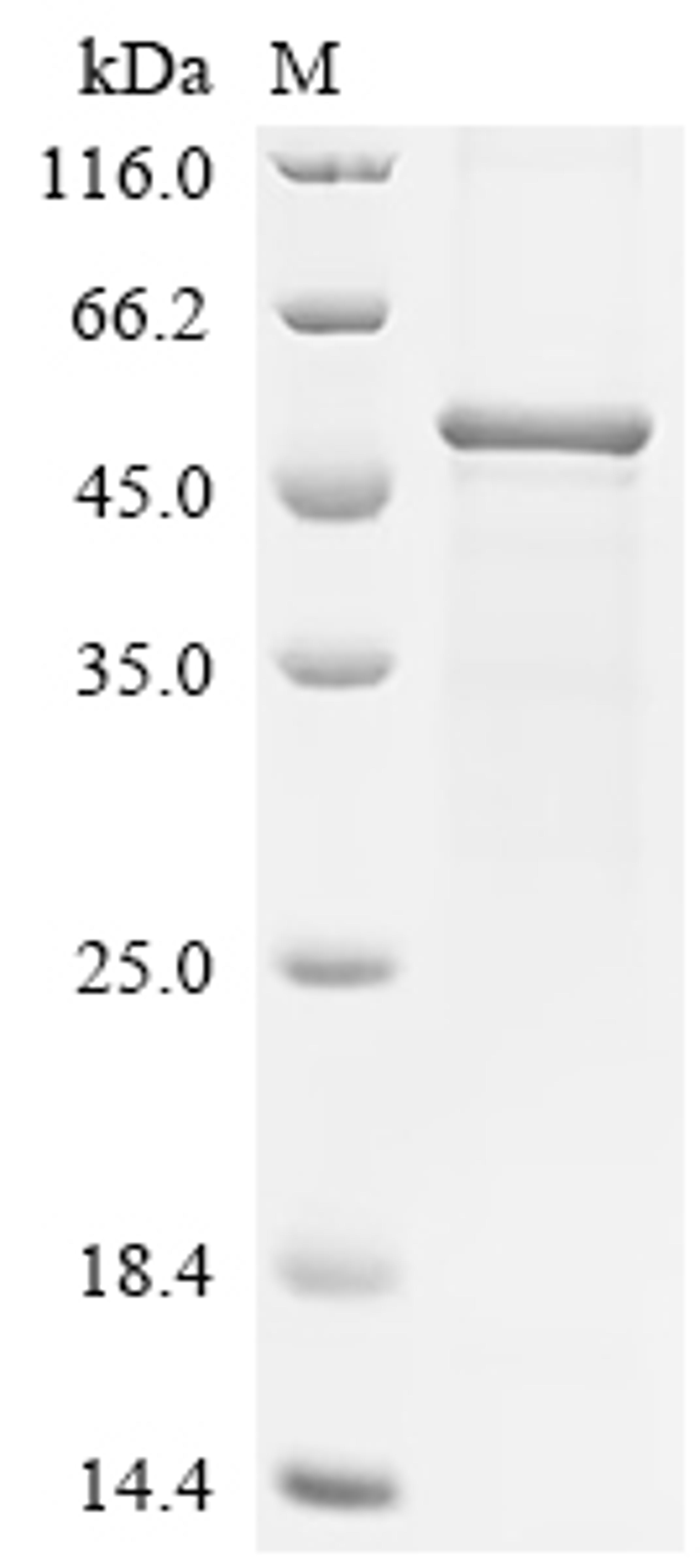 (Tris-Glycine gel) Discontinuous SDS-PAGE (reduced) with 5% enrichment gel and 15% separation gel.