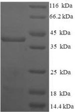 (Tris-Glycine gel) Discontinuous SDS-PAGE (reduced) with 5% enrichment gel and 15% separation gel.