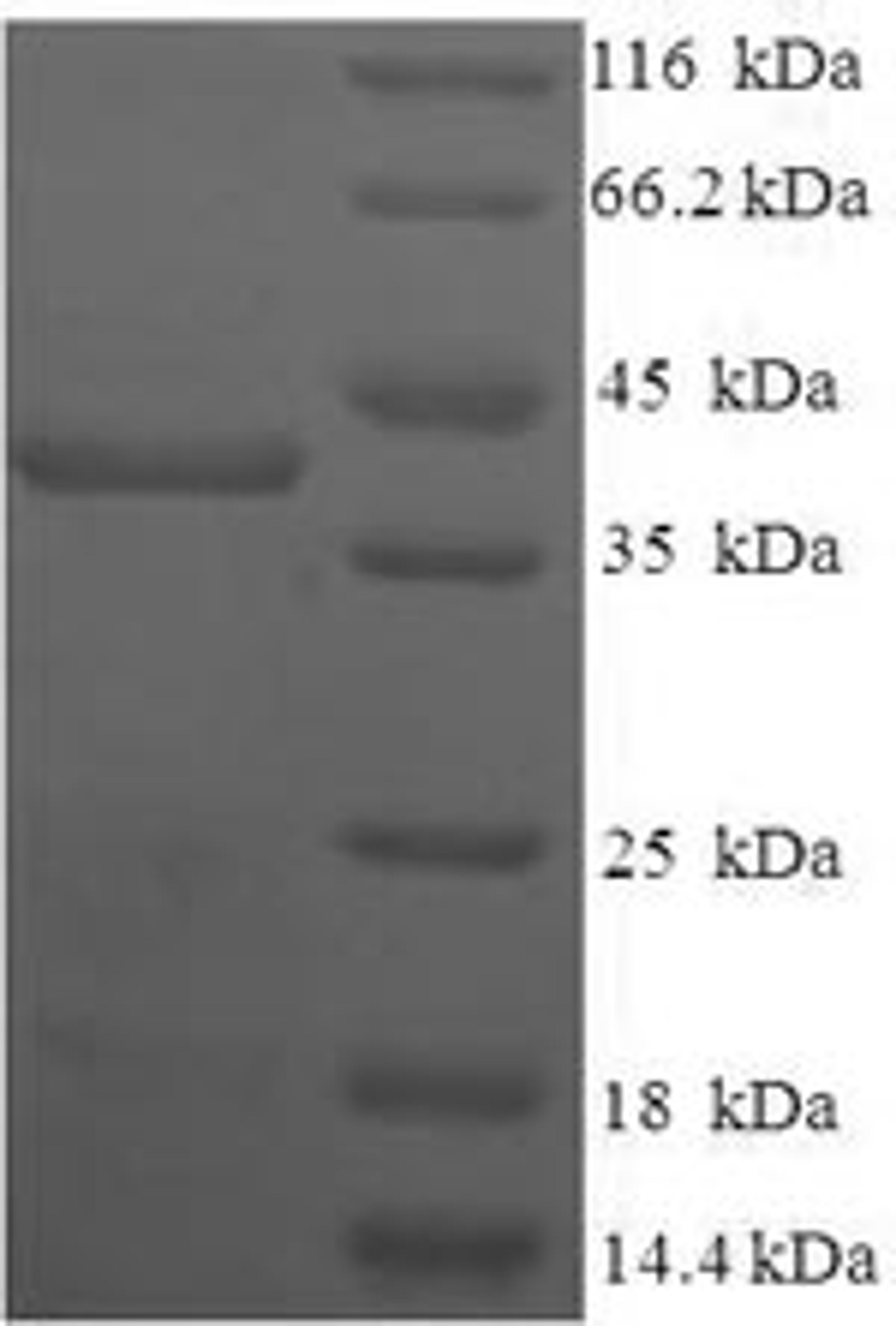 (Tris-Glycine gel) Discontinuous SDS-PAGE (reduced) with 5% enrichment gel and 15% separation gel.