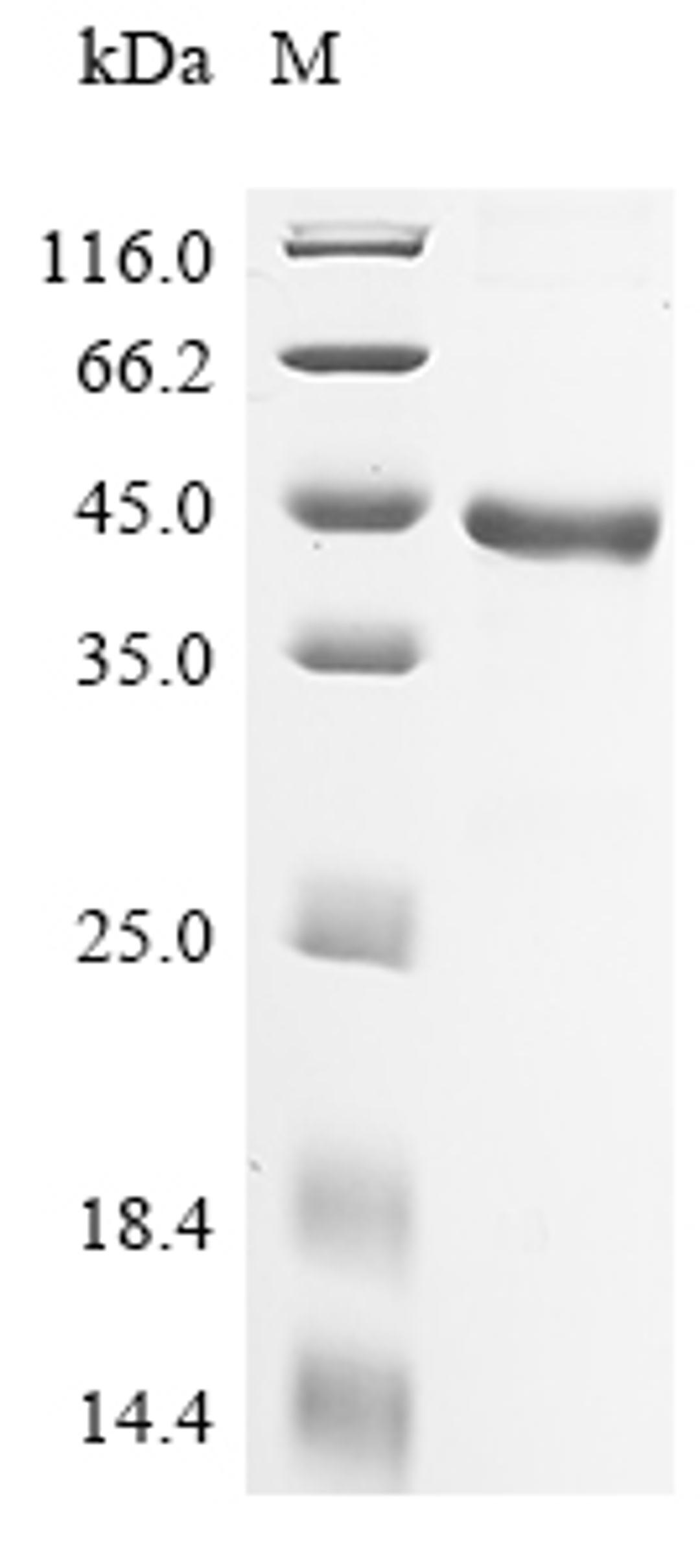 (Tris-Glycine gel) Discontinuous SDS-PAGE (reduced) with 5% enrichment gel and 15% separation gel.