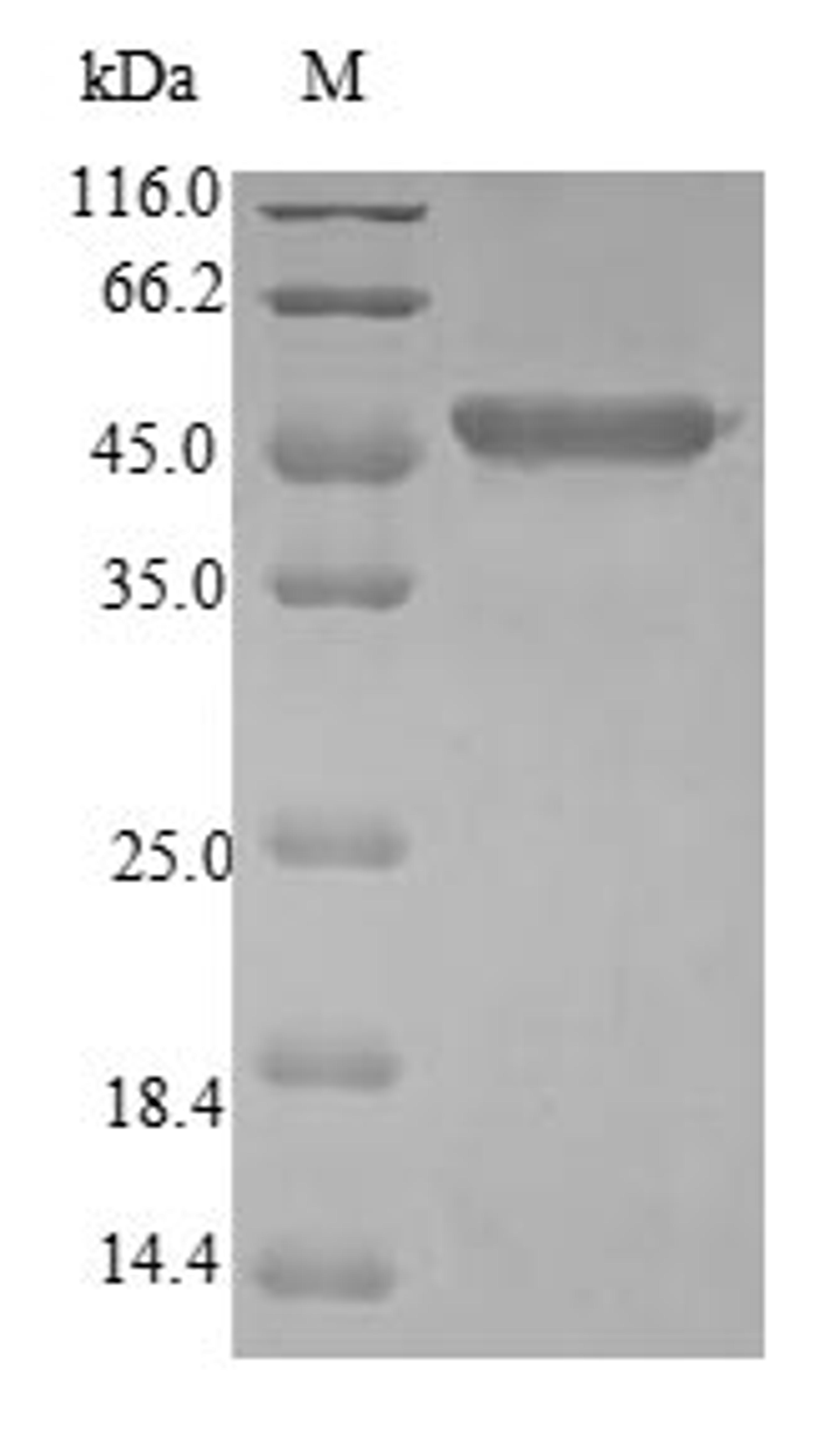 (Tris-Glycine gel) Discontinuous SDS-PAGE (reduced) with 5% enrichment gel and 15% separation gel.
