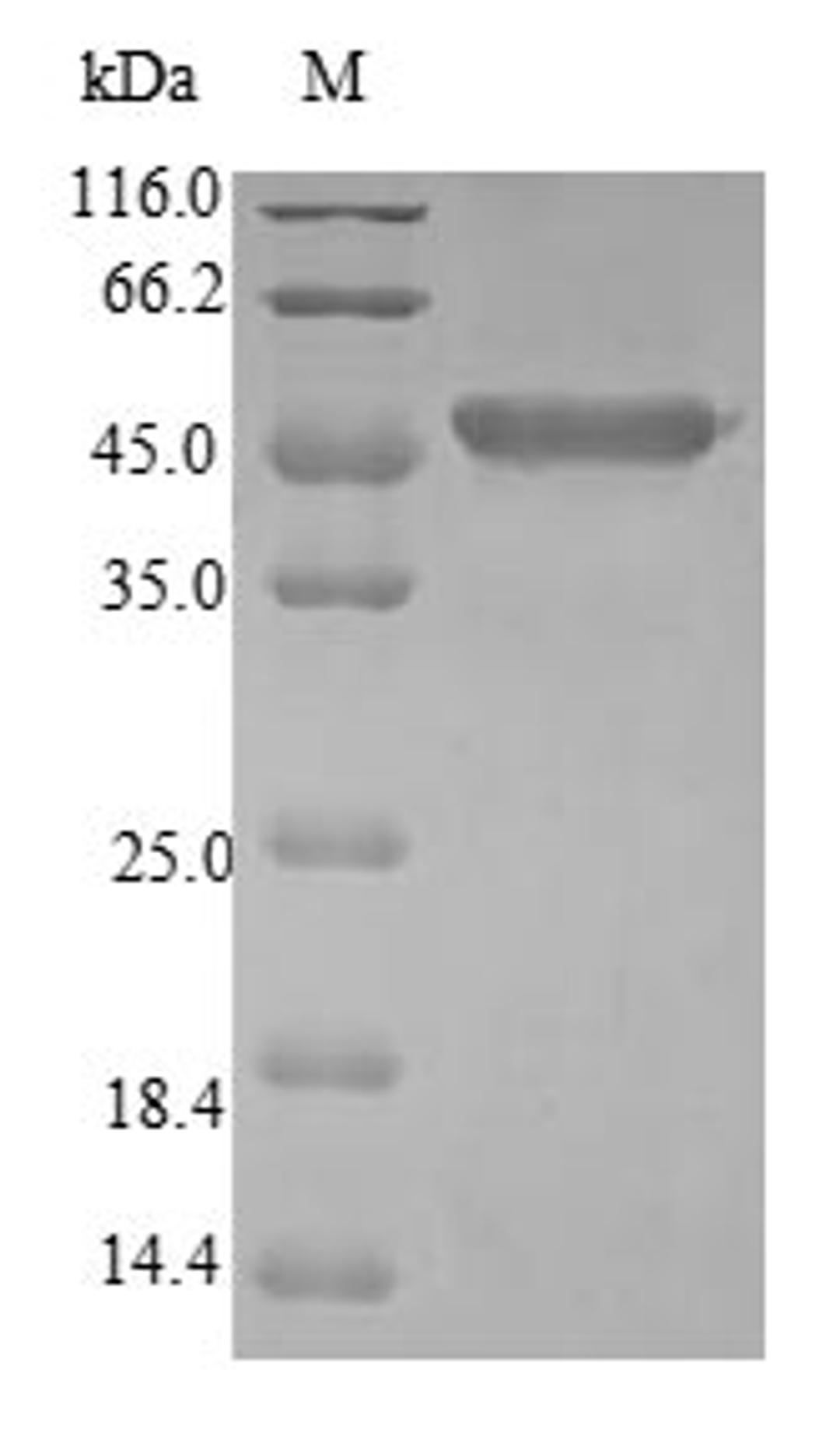 (Tris-Glycine gel) Discontinuous SDS-PAGE (reduced) with 5% enrichment gel and 15% separation gel.