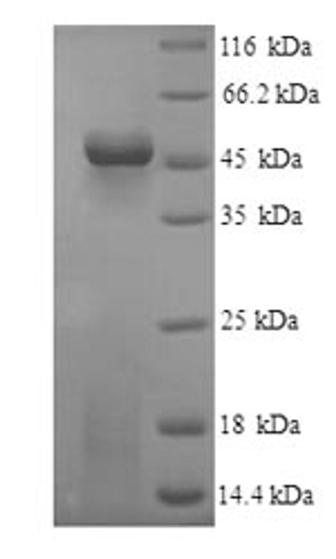 (Tris-Glycine gel) Discontinuous SDS-PAGE (reduced) with 5% enrichment gel and 15% separation gel.