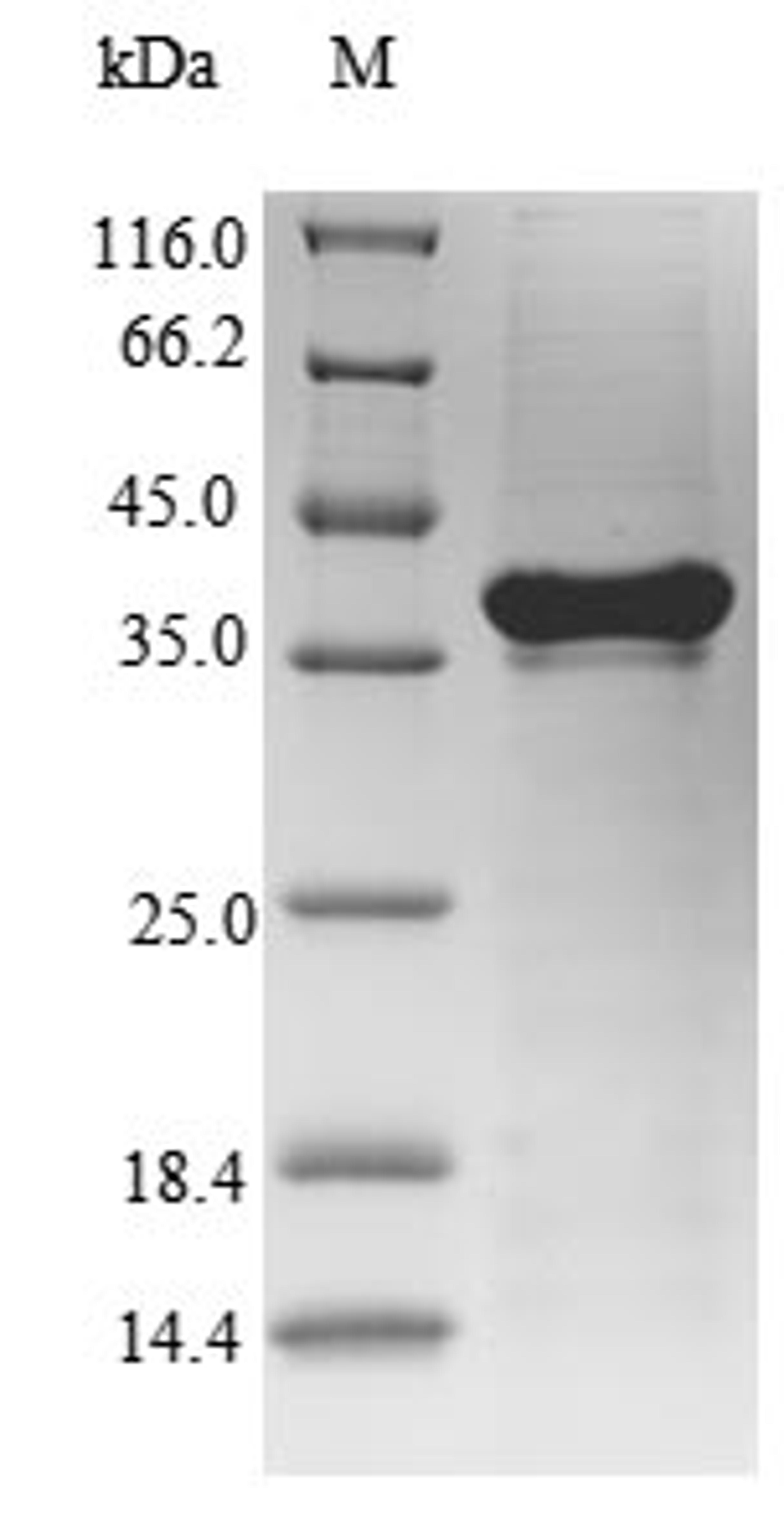 (Tris-Glycine gel) Discontinuous SDS-PAGE (reduced) with 5% enrichment gel and 15% separation gel.