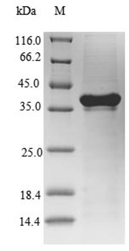 (Tris-Glycine gel) Discontinuous SDS-PAGE (reduced) with 5% enrichment gel and 15% separation gel.