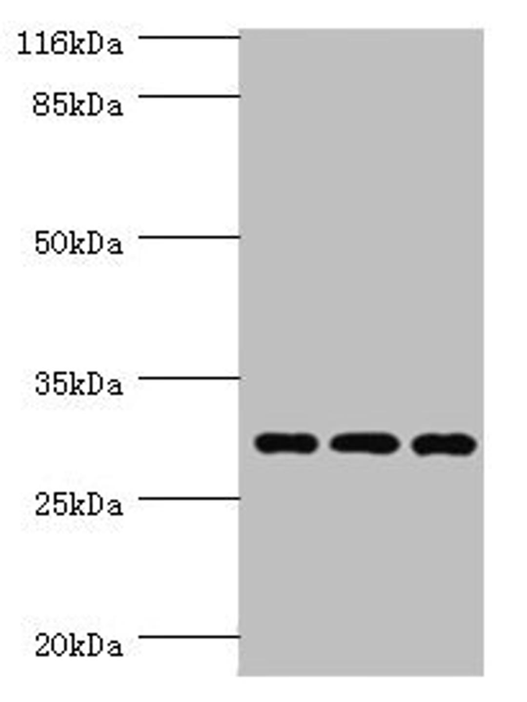 Western blot. All lanes: SPIN1 antibody at 1.45µg/ml. Lane 1: Hela whole cell lysate. Lane 2: 293T whole cell lysate. Lane 3: HepG2 whole cell lysate. Secondary. Goat polyclonal to rabbit IgG at 1/10000 dilution. Predicted band size: 30 kDa. Observed band size: 30 kDa