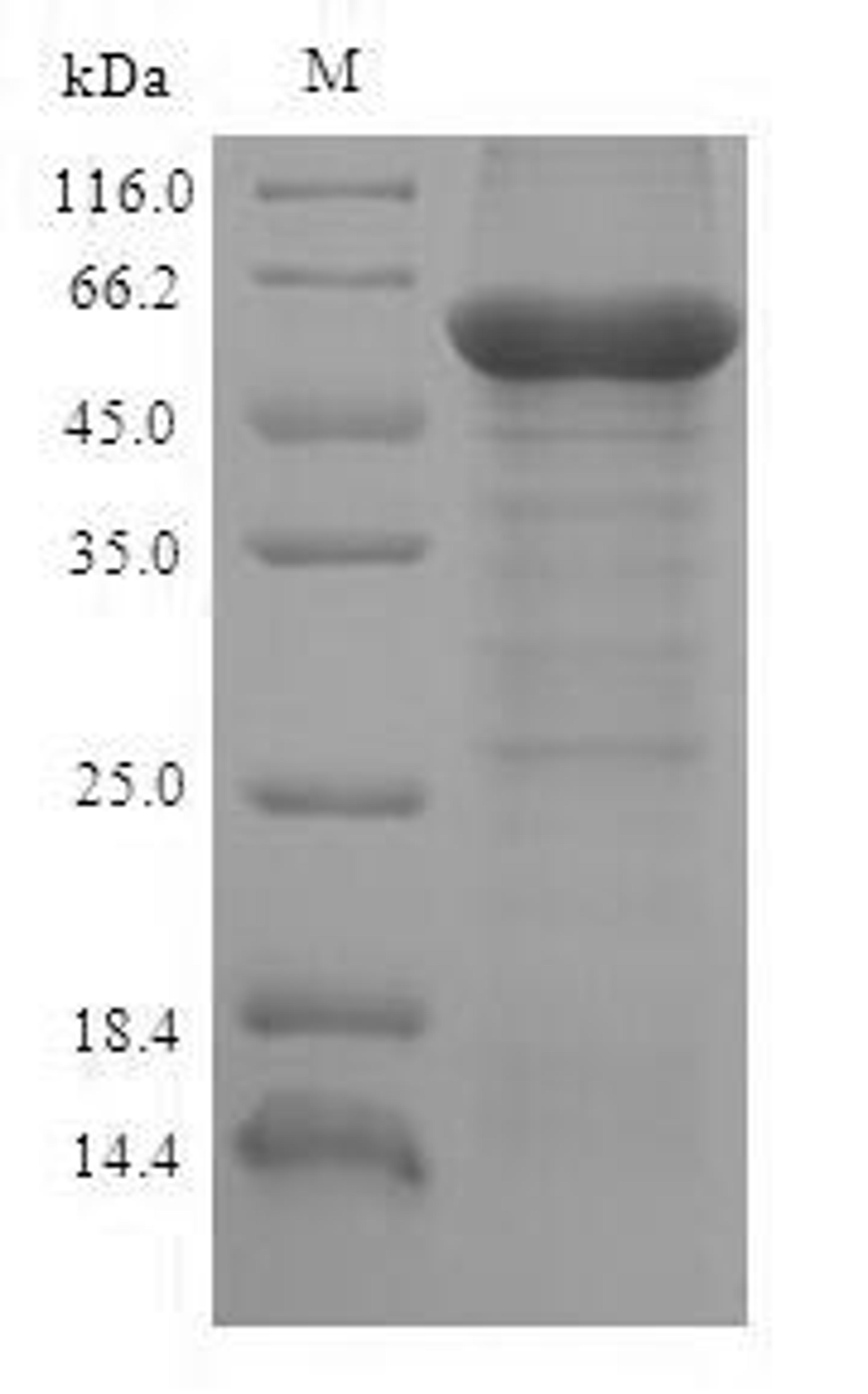 (Tris-Glycine gel) Discontinuous SDS-PAGE (reduced) with 5% enrichment gel and 15% separation gel.