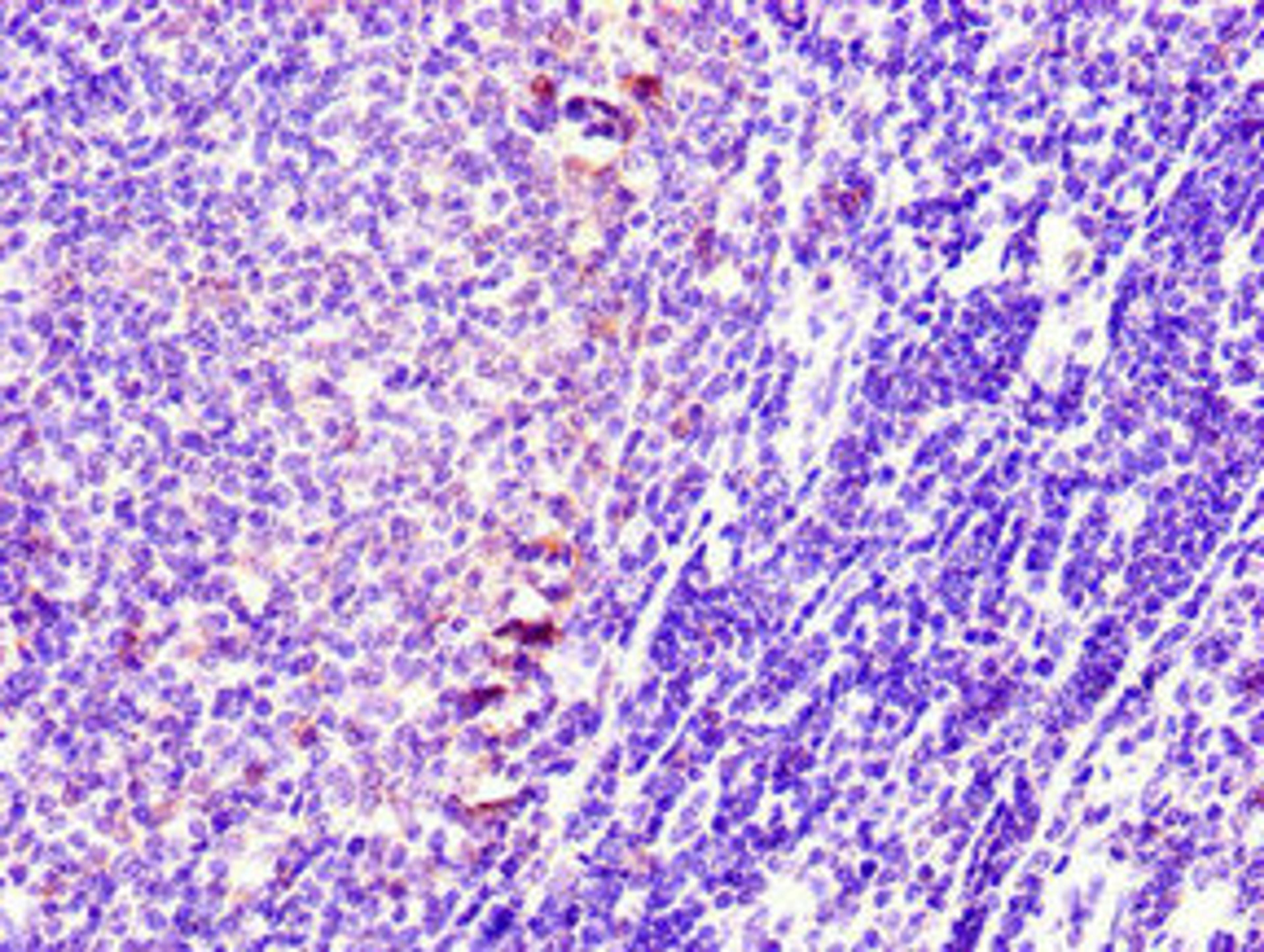 Immunohistochemistry of paraffin-embedded human lymph node tissue using CSB-PA022857LA01HU at dilution of 1:100