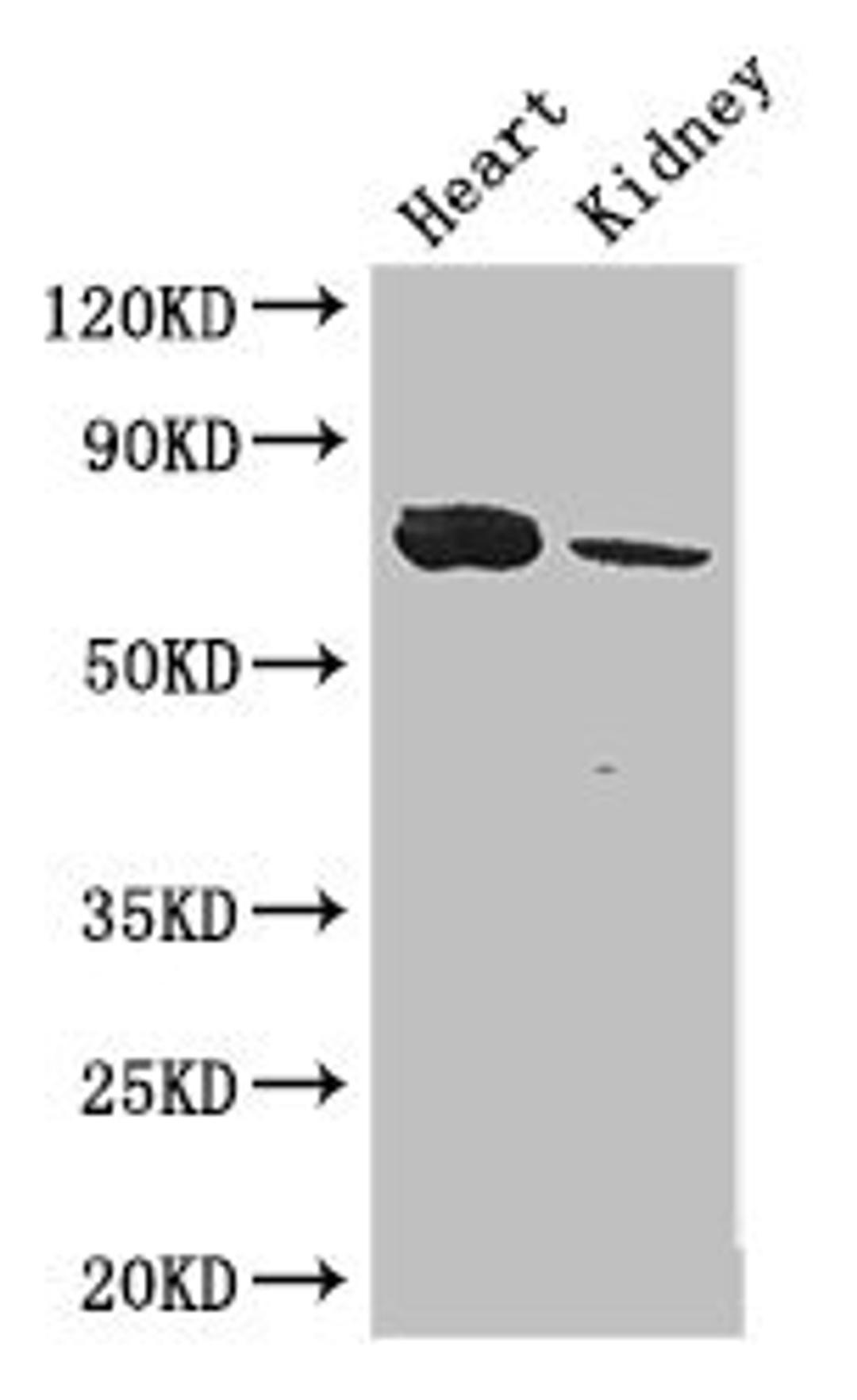 Western Blot. Positive WB detected in: Mouse heart tissue, Mouse kidney tissue. All lanes: MED17 antibody at 2.8ug/ml. Secondary. Goat polyclonal to rabbit IgG at 1/50000 dilution. Predicted band size: 73, 16 kDa. Observed band size: 73 kDa. 