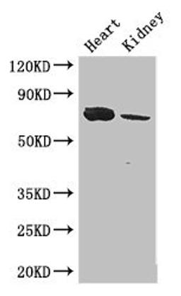Western Blot. Positive WB detected in: Mouse heart tissue, Mouse kidney tissue. All lanes: MED17 antibody at 2.8ug/ml. Secondary. Goat polyclonal to rabbit IgG at 1/50000 dilution. Predicted band size: 73, 16 kDa. Observed band size: 73 kDa. 