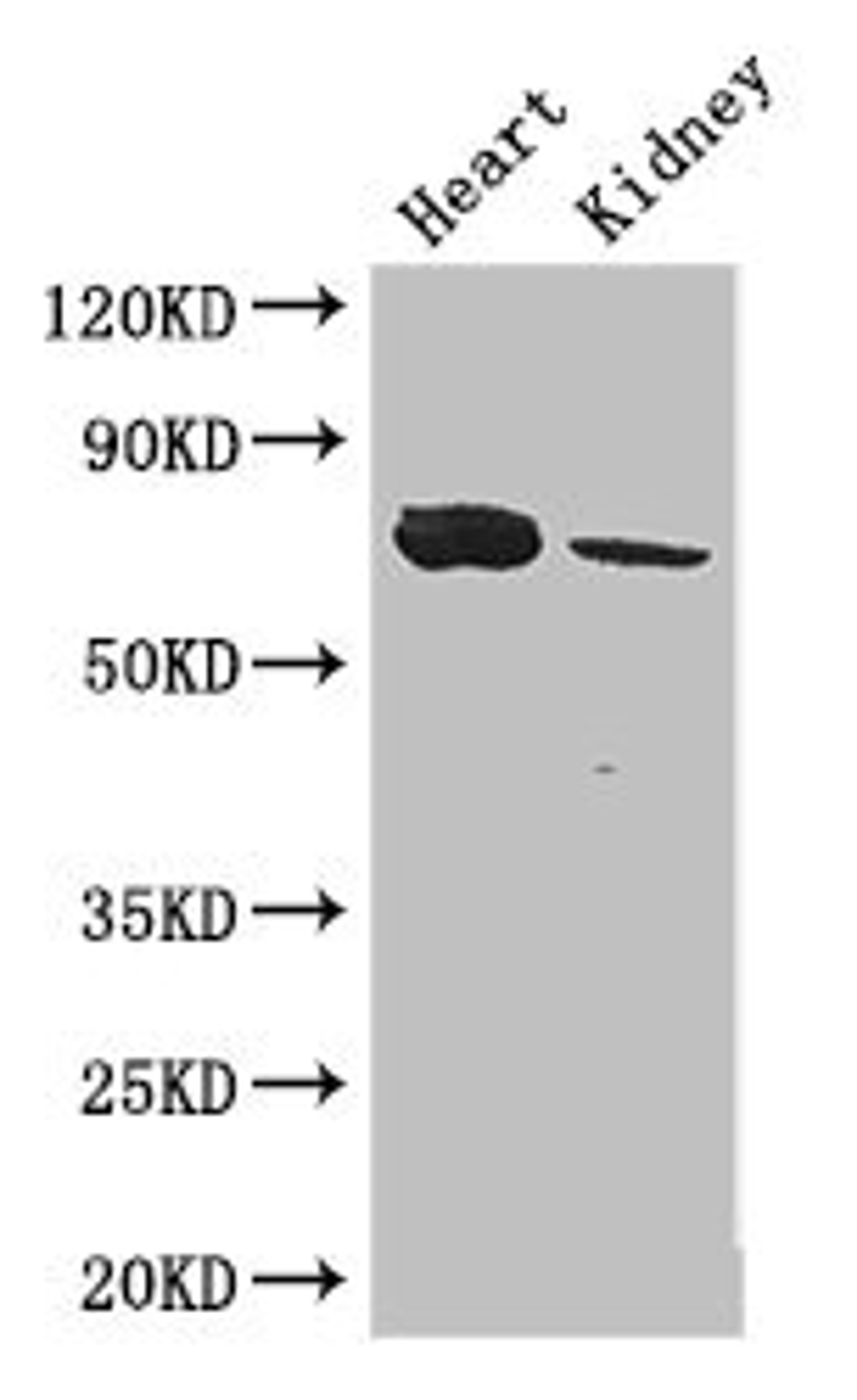 Western Blot. Positive WB detected in: Mouse heart tissue, Mouse kidney tissue. All lanes: MED17 antibody at 2.8ug/ml. Secondary. Goat polyclonal to rabbit IgG at 1/50000 dilution. Predicted band size: 73, 16 kDa. Observed band size: 73 kDa. 