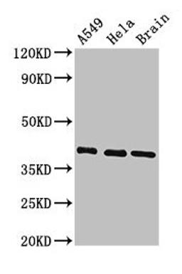 Western Blot. Positive WB detected in: A549 whole cell lysate, Hela whole cell lysate, Mouse brain tissue. All lanes: HLA-C antibody at 3.4µg/ml. Secondary. Goat polyclonal to rabbit IgG at 1/50000 dilution. Predicted band size: 41 kDa. Observed band size: 41 kDa