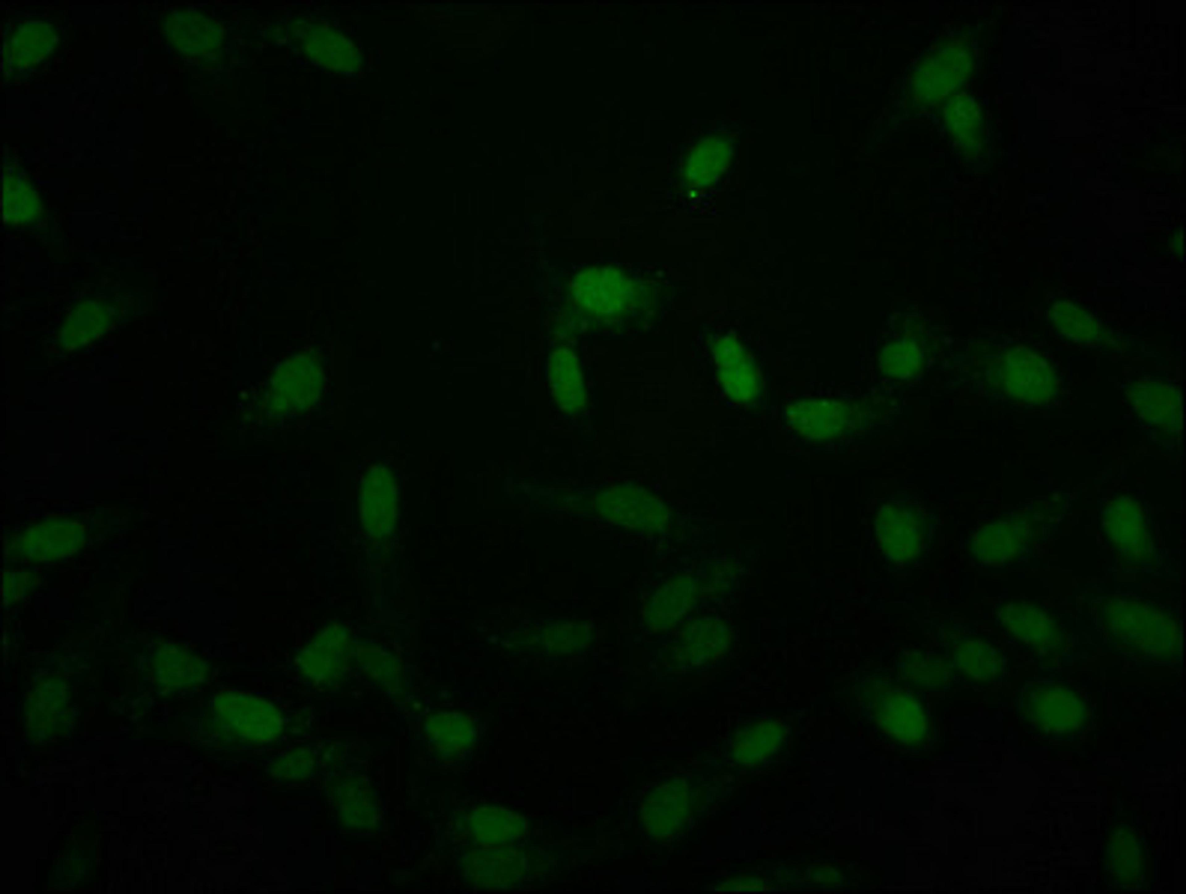 Immunofluorescence staining of Hela cells with CSB-PA010389PA118crHU at 1:50, counter-stained with DAPI. The cells were fixed in 4% formaldehyde, permeabilized using 0.2% Triton X-100 and blocked in 10% normal Goat Serum. The cells were then incubated with the antibody overnight at 4&deg;C. The secondary antibody was Alexa Fluor 488-congugated AffiniPure Goat Anti-Rabbit IgG(H+L).