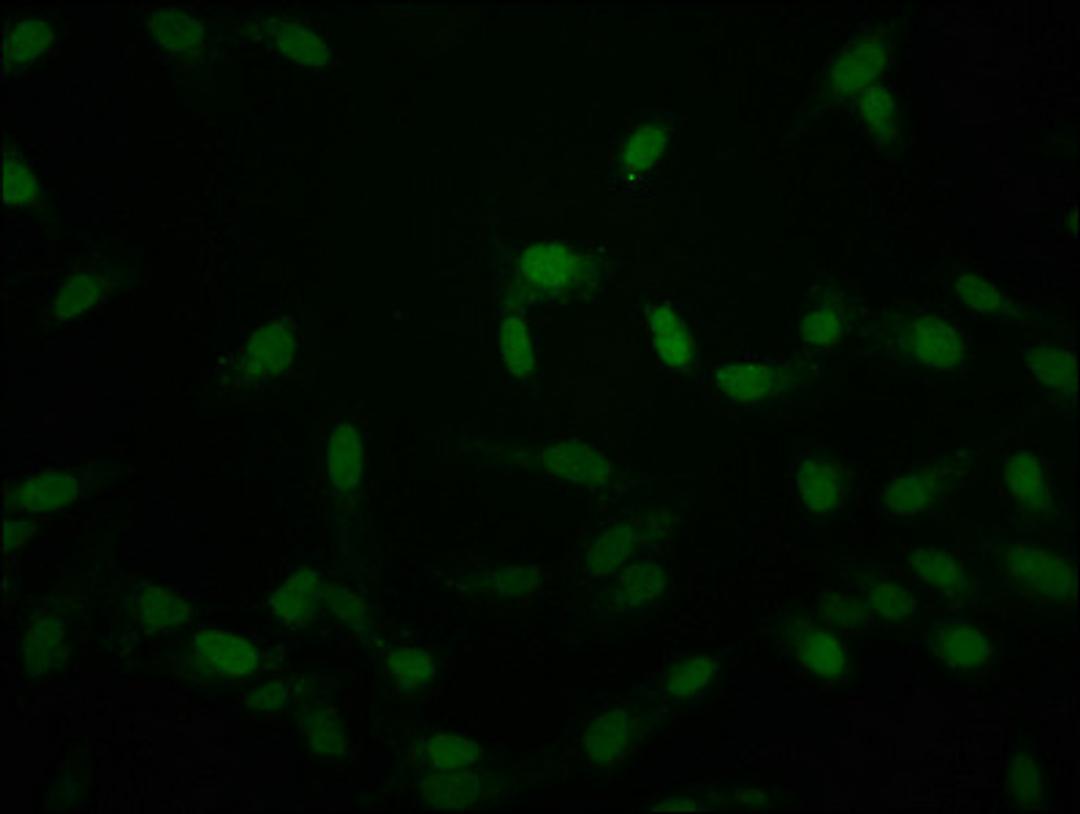 Immunofluorescence staining of Hela cells with CSB-PA010389PA118crHU at 1:50, counter-stained with DAPI. The cells were fixed in 4% formaldehyde, permeabilized using 0.2% Triton X-100 and blocked in 10% normal Goat Serum. The cells were then incubated with the antibody overnight at 4°C. The secondary antibody was Alexa Fluor 488-congugated AffiniPure Goat Anti-Rabbit IgG(H+L).