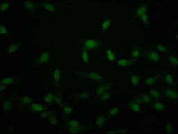 Immunofluorescence staining of Hela cells with CSB-PA010389PA118crHU at 1:50, counter-stained with DAPI. The cells were fixed in 4% formaldehyde, permeabilized using 0.2% Triton X-100 and blocked in 10% normal Goat Serum. The cells were then incubated with the antibody overnight at 4°C. The secondary antibody was Alexa Fluor 488-congugated AffiniPure Goat Anti-Rabbit IgG(H+L).