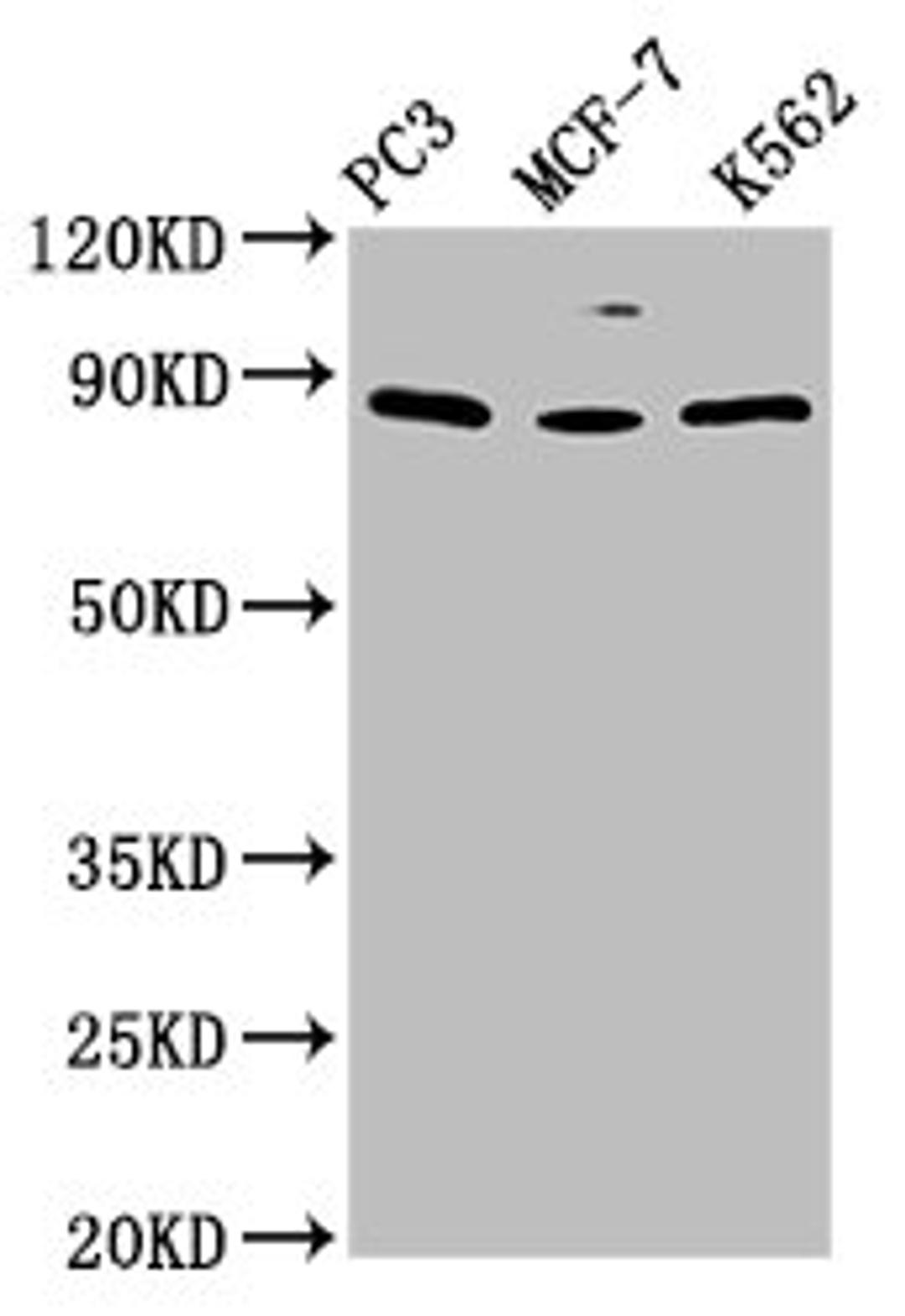 Western Blot. Positive WB detected in: PC-3 whole cell lysate, MCF-7 whole cell lysate, K562 whole cell lysate. All lanes: TRIM28 antibody at 1.5ug/ml. Secondary. Goat polyclonal to rabbit IgG at 1/50000 dilution. Predicted band size: 89, 80 kDa. Observed band size: 89 kDa. 