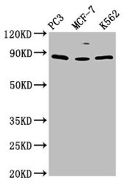 Western Blot. Positive WB detected in: PC-3 whole cell lysate, MCF-7 whole cell lysate, K562 whole cell lysate. All lanes: TRIM28 antibody at 1.5ug/ml. Secondary. Goat polyclonal to rabbit IgG at 1/50000 dilution. Predicted band size: 89, 80 kDa. Observed band size: 89 kDa. 