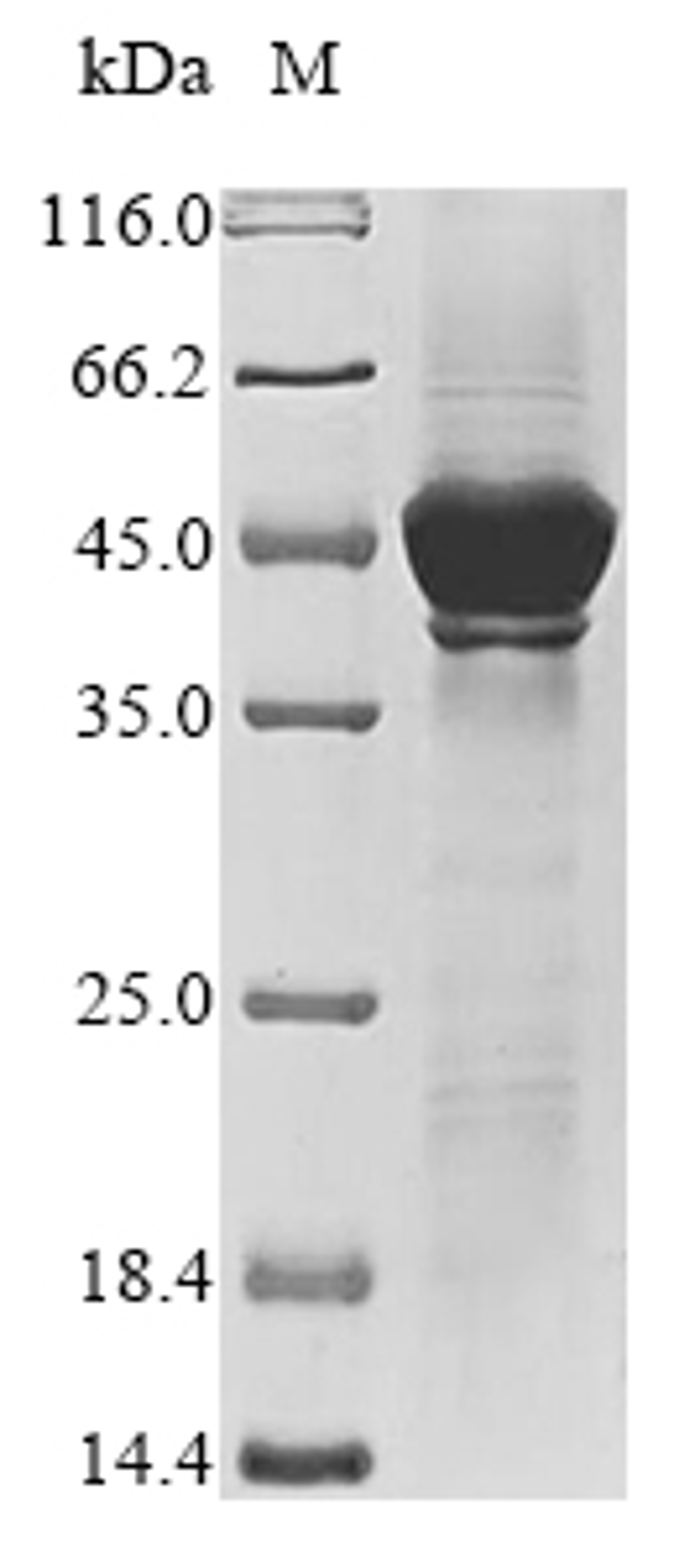 (Tris-Glycine gel) Discontinuous SDS-PAGE (reduced) with 5% enrichment gel and 15% separation gel.