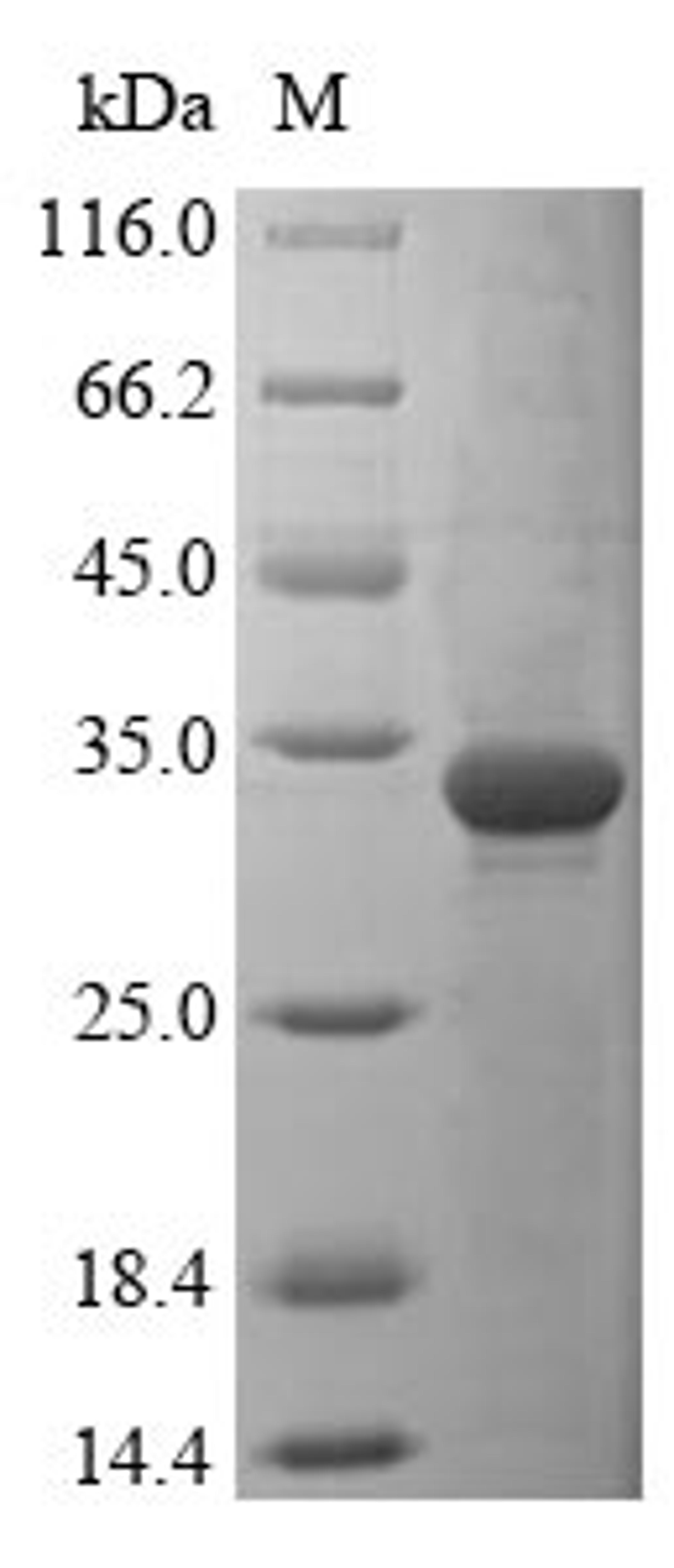 (Tris-Glycine gel) Discontinuous SDS-PAGE (reduced) with 5% enrichment gel and 15% separation gel.