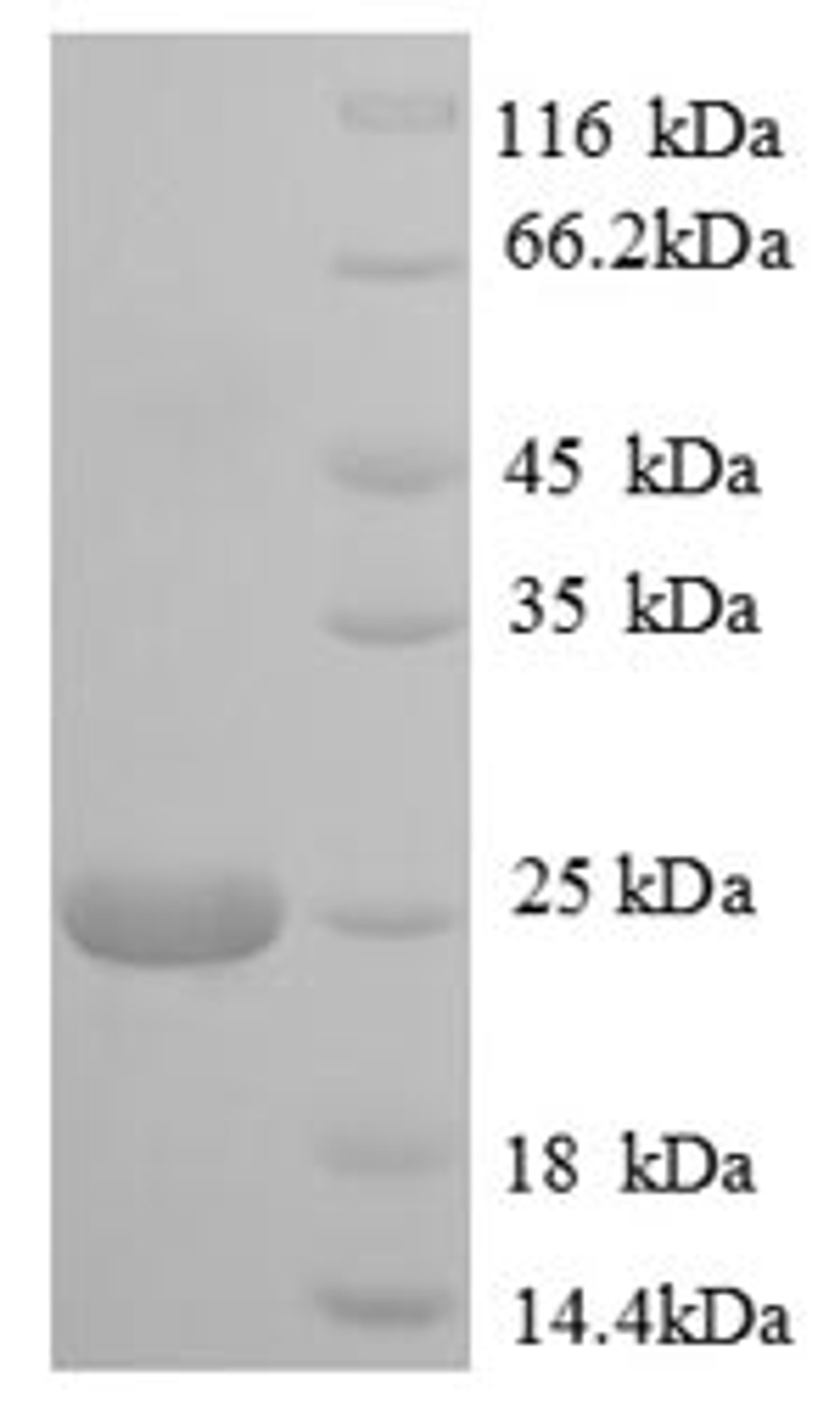 (Tris-Glycine gel) Discontinuous SDS-PAGE (reduced) with 5% enrichment gel and 15% separation gel.