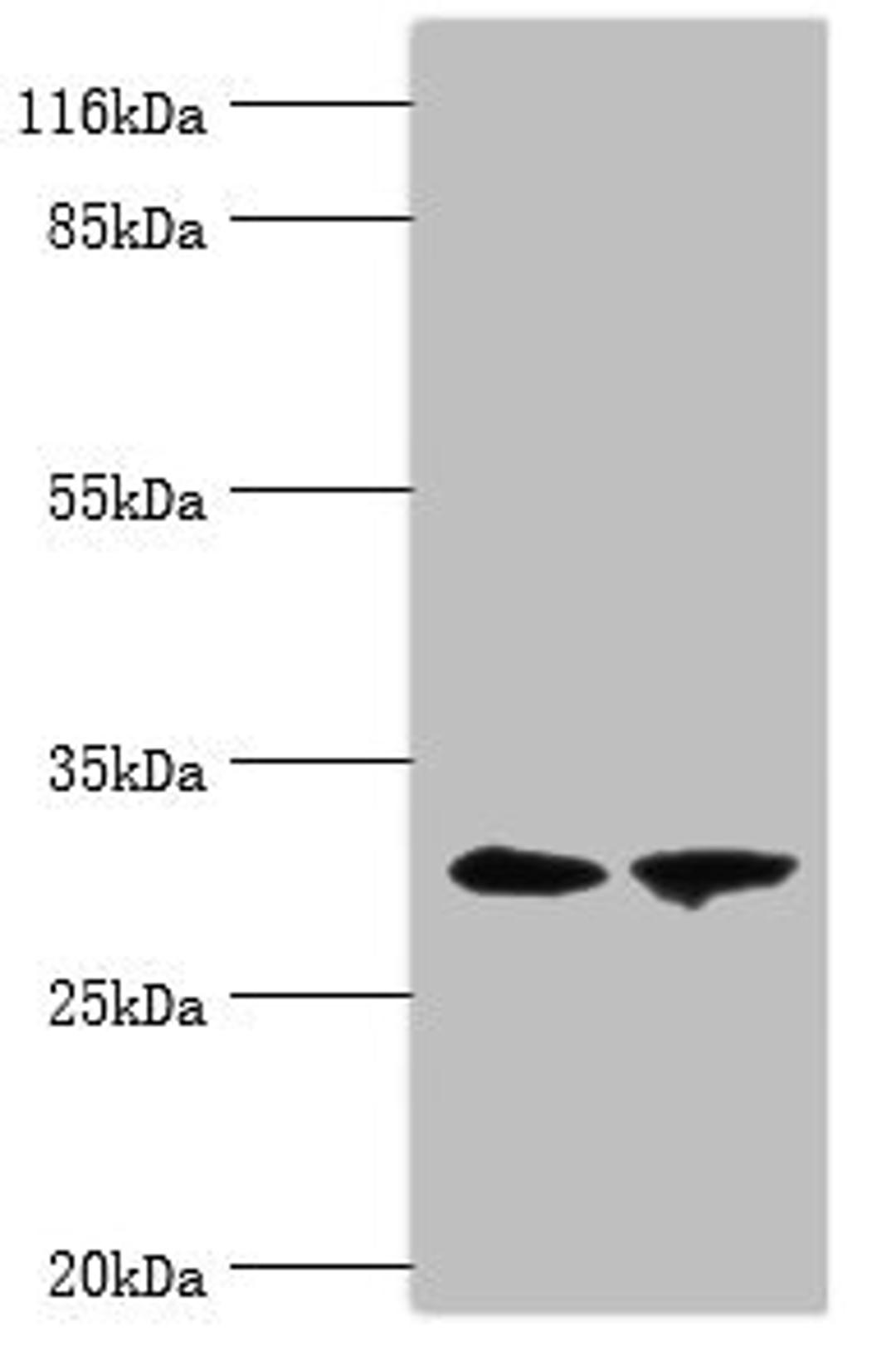 Western blot. All lanes: ACBD4 antibody at 2µg/ml. Lane 1: Mouse kidney tissue. Lane 2: Mouse liver tissue. Secondary. Goat polyclonal to rabbit IgG at 1/10000 dilution. Predicted band size: 31, 35, 38 kDa. Observed band size: 31 kDa