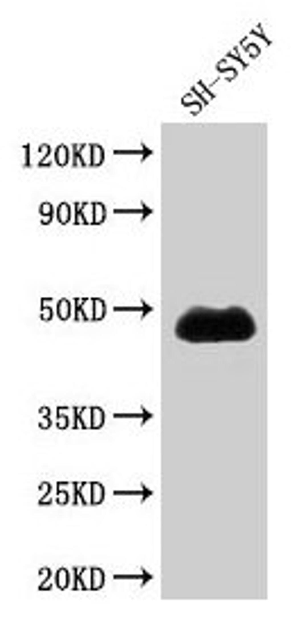 Western Blot. Positive WB detected in: SH-SY5Y whole cell lysate. All lanes: NADK antibody at 1.7µg/ml. Secondary. Goat polyclonal to rabbit IgG at 1/50000 dilution. Predicted band size: 50, 64, 47 kDa. Observed band size: 47 kDa