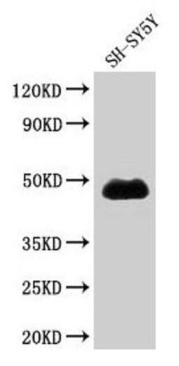 Western Blot. Positive WB detected in: SH-SY5Y whole cell lysate. All lanes: NADK antibody at 1.7µg/ml. Secondary. Goat polyclonal to rabbit IgG at 1/50000 dilution. Predicted band size: 50, 64, 47 kDa. Observed band size: 47 kDa