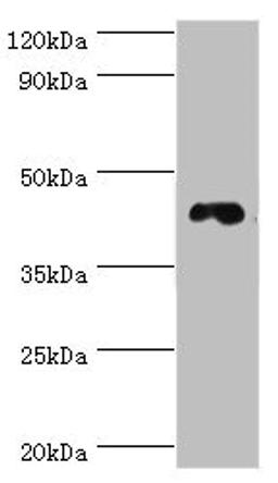 Western blot. All lanes: DRD3 antibody at 6ug/ml + HepG2 whole cell lysate. Secondary. Goat polyclonal to rabbit IgG at 1/10000 dilution. Predicted band size: 45, 41 kDa. Observed band size: 45 kDa. 