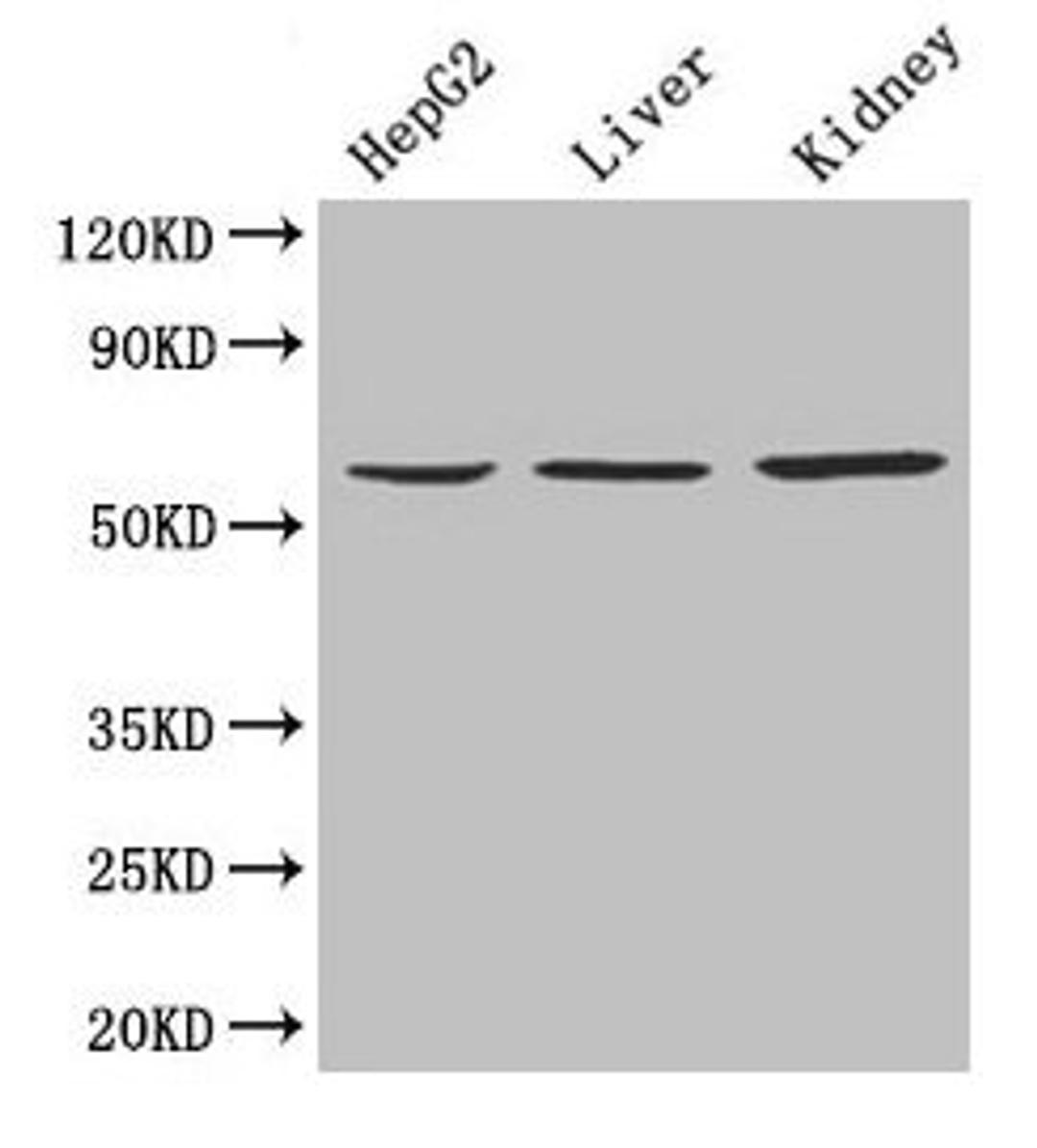 Western Blot. Positive WB detected in: HepG2 whole cell lysate, Mouse liver tissue, Mouse kidney tissue. All lanes: NAPRT antibody at 4µg/ml. Secondary. Goat polyclonal to rabbit IgG at 1/10000 dilution. Predicted band size: 58, 61, 57 kDa. Observed band size: 58 kDa