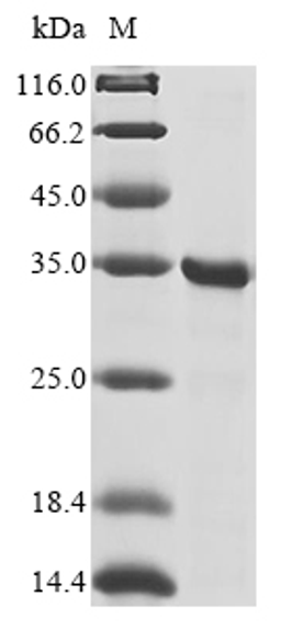 (Tris-Glycine gel) Discontinuous SDS-PAGE (reduced) with 5% enrichment gel and 15% separation gel.