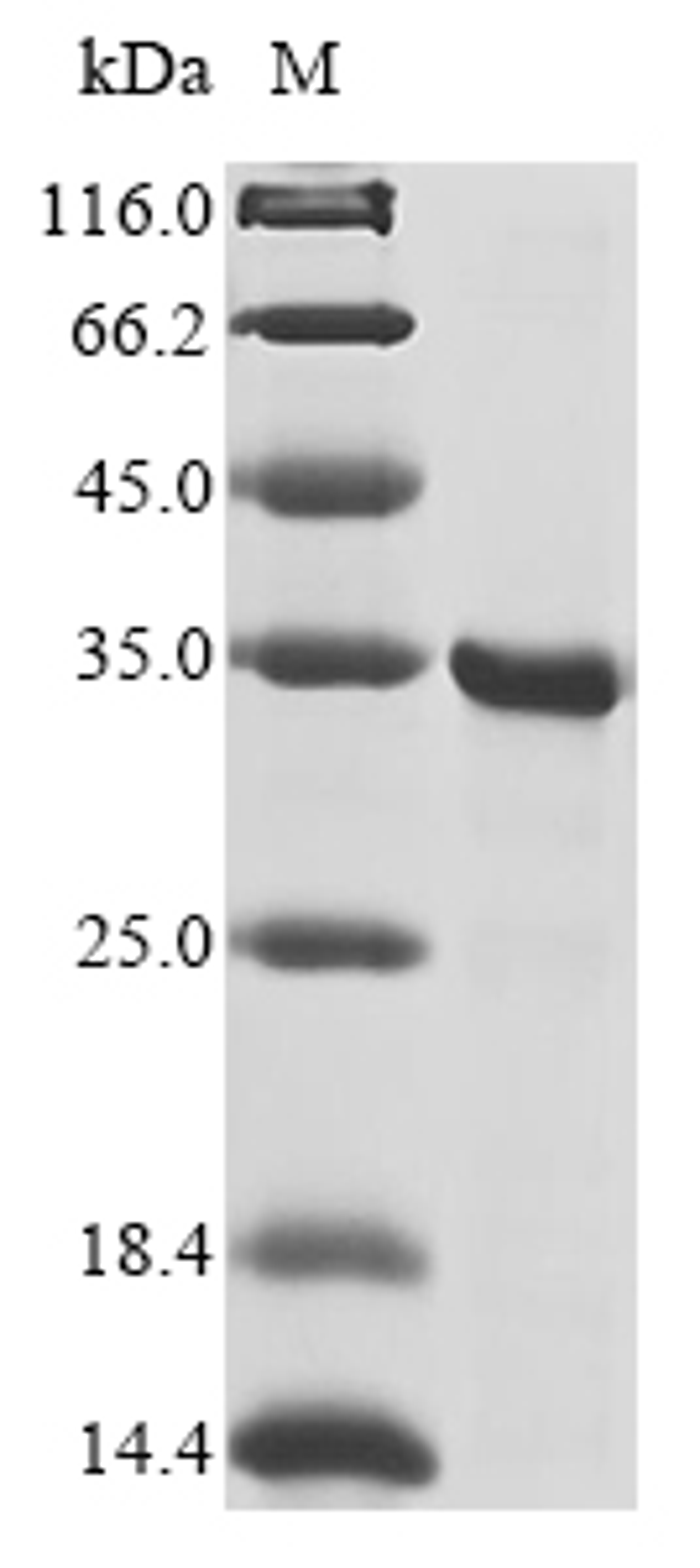 (Tris-Glycine gel) Discontinuous SDS-PAGE (reduced) with 5% enrichment gel and 15% separation gel.