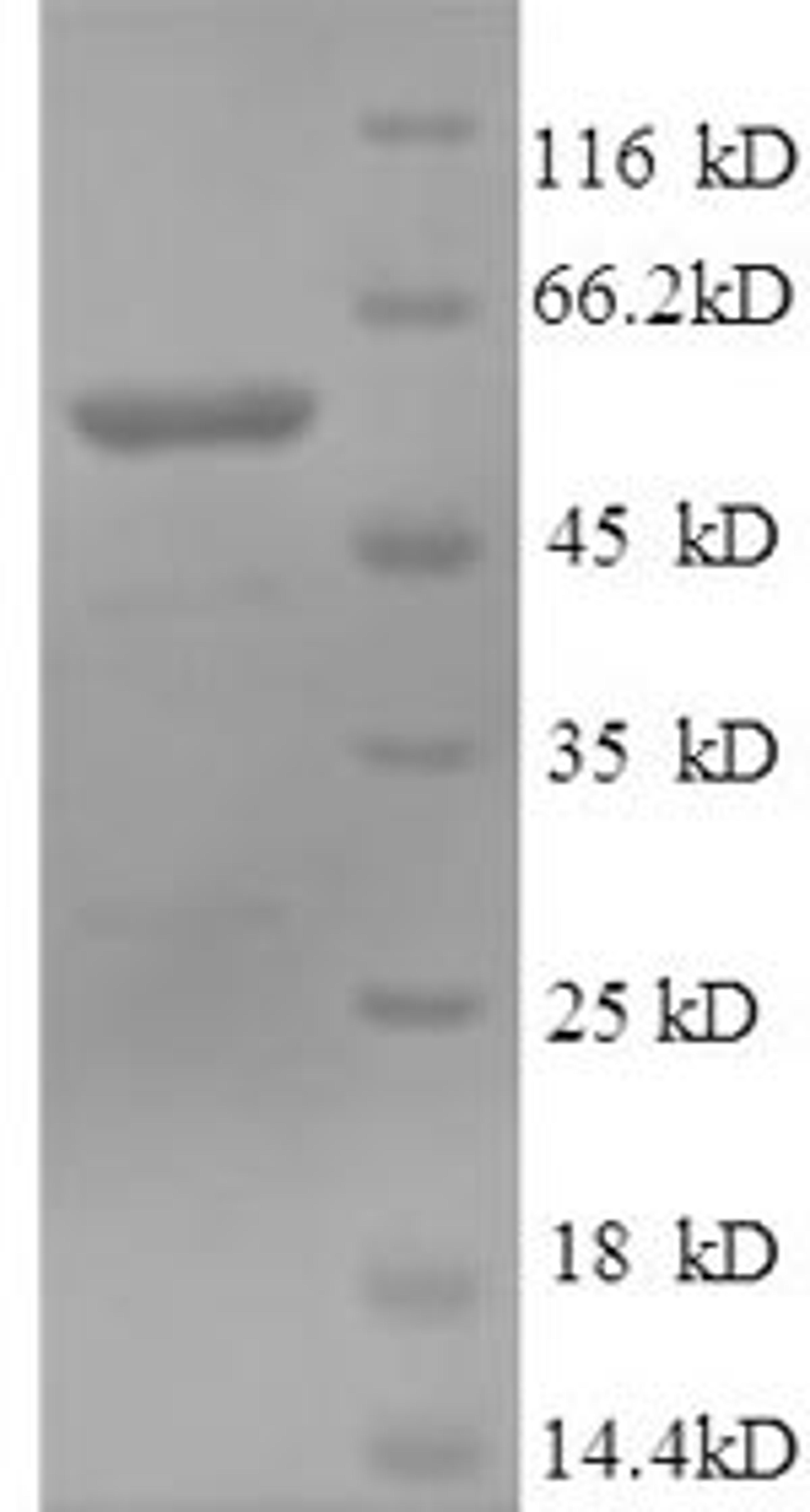 (Tris-Glycine gel) Discontinuous SDS-PAGE (reduced) with 5% enrichment gel and 15% separation gel.