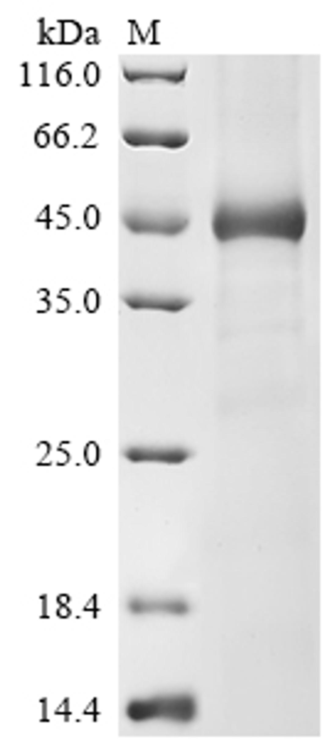 (Tris-Glycine gel) Discontinuous SDS-PAGE (reduced) with 5% enrichment gel and 15% separation gel.